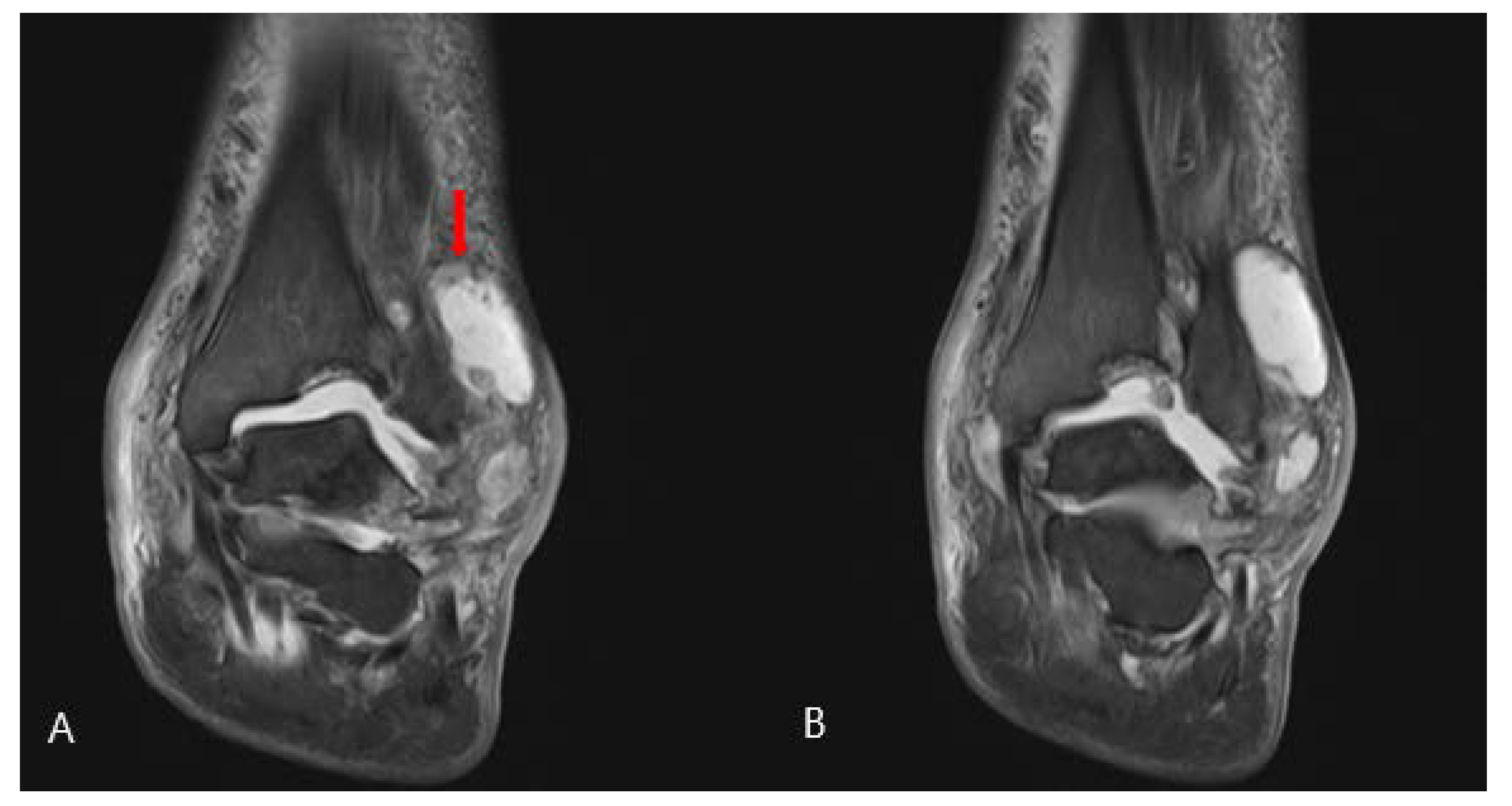 Medicina 58 01776 g004