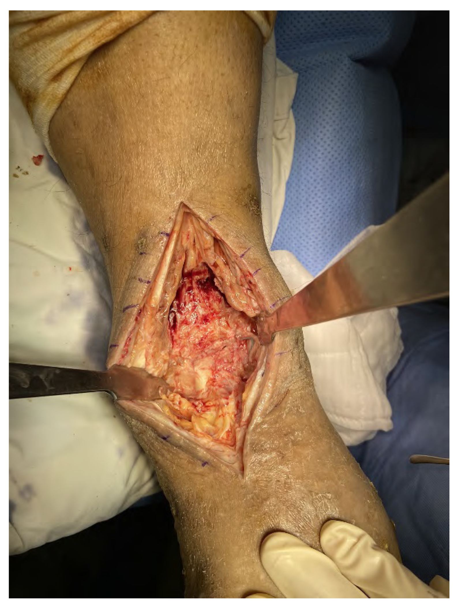 Medicina 58 01776 g006