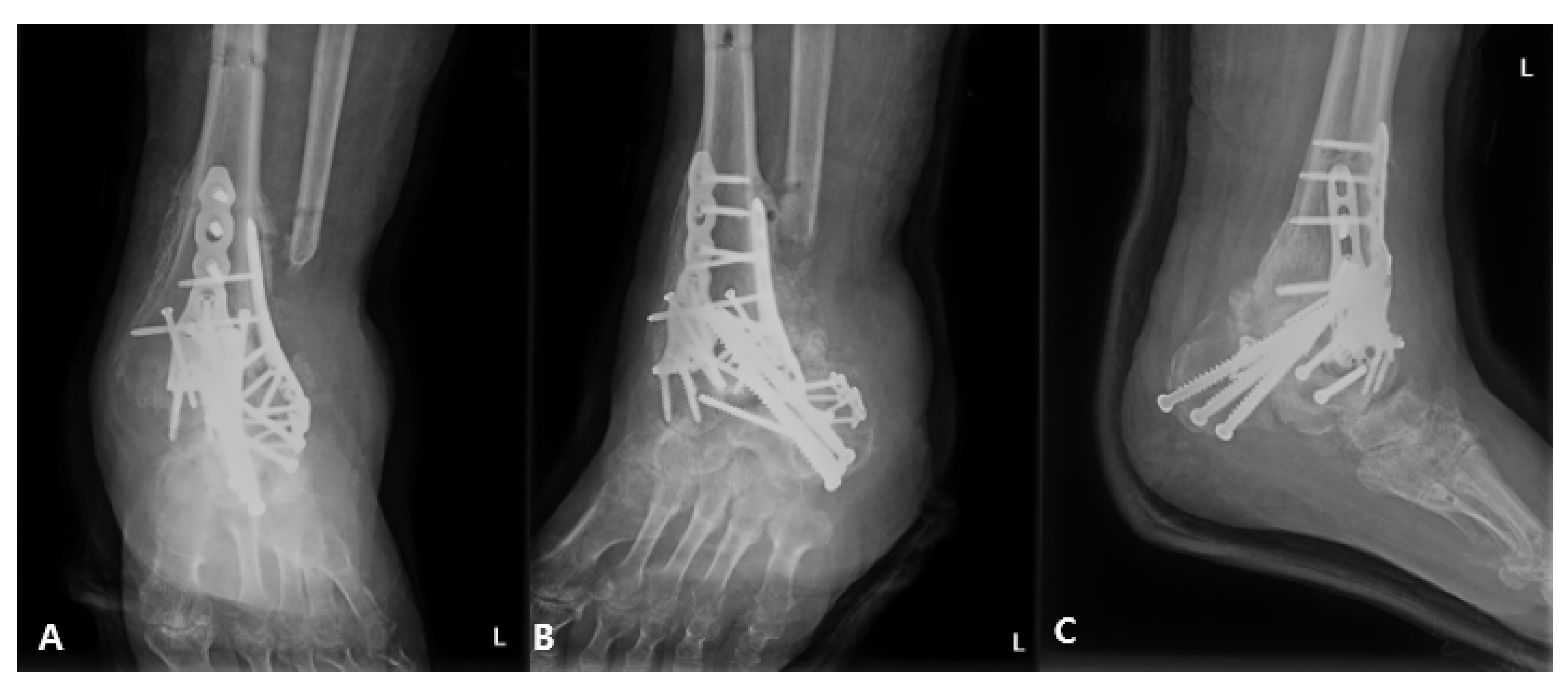 Medicina 58 01776 g007