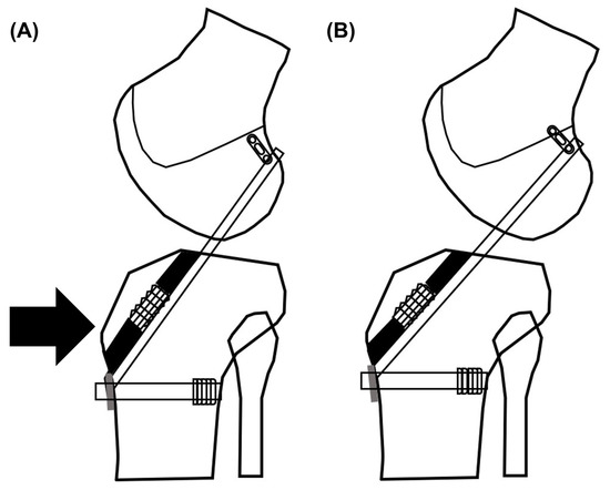 III. Factors Influencing the Shift in Holster Preferences for Women