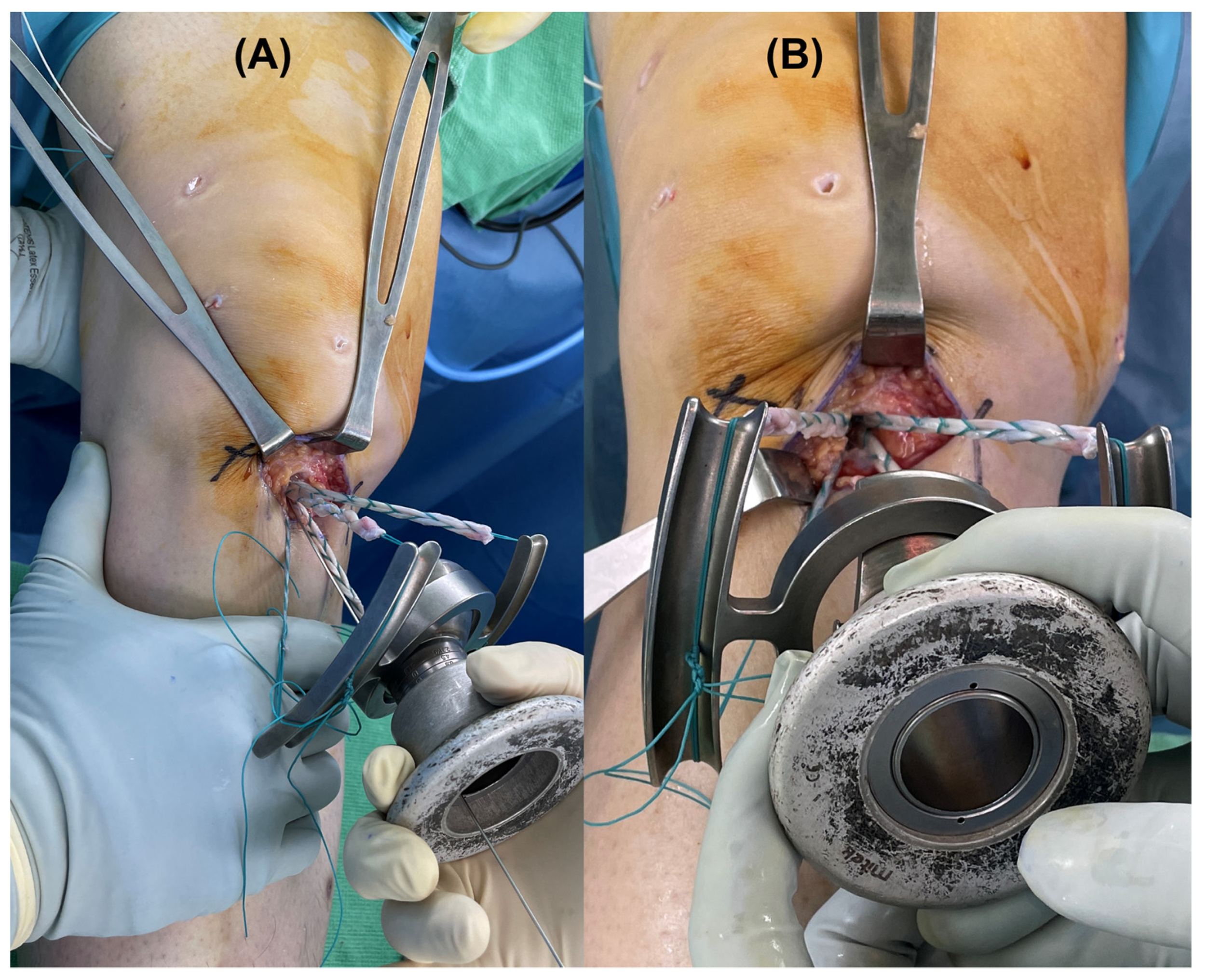 Medicina 58 01787 g004 Medicina 58 01787 g004