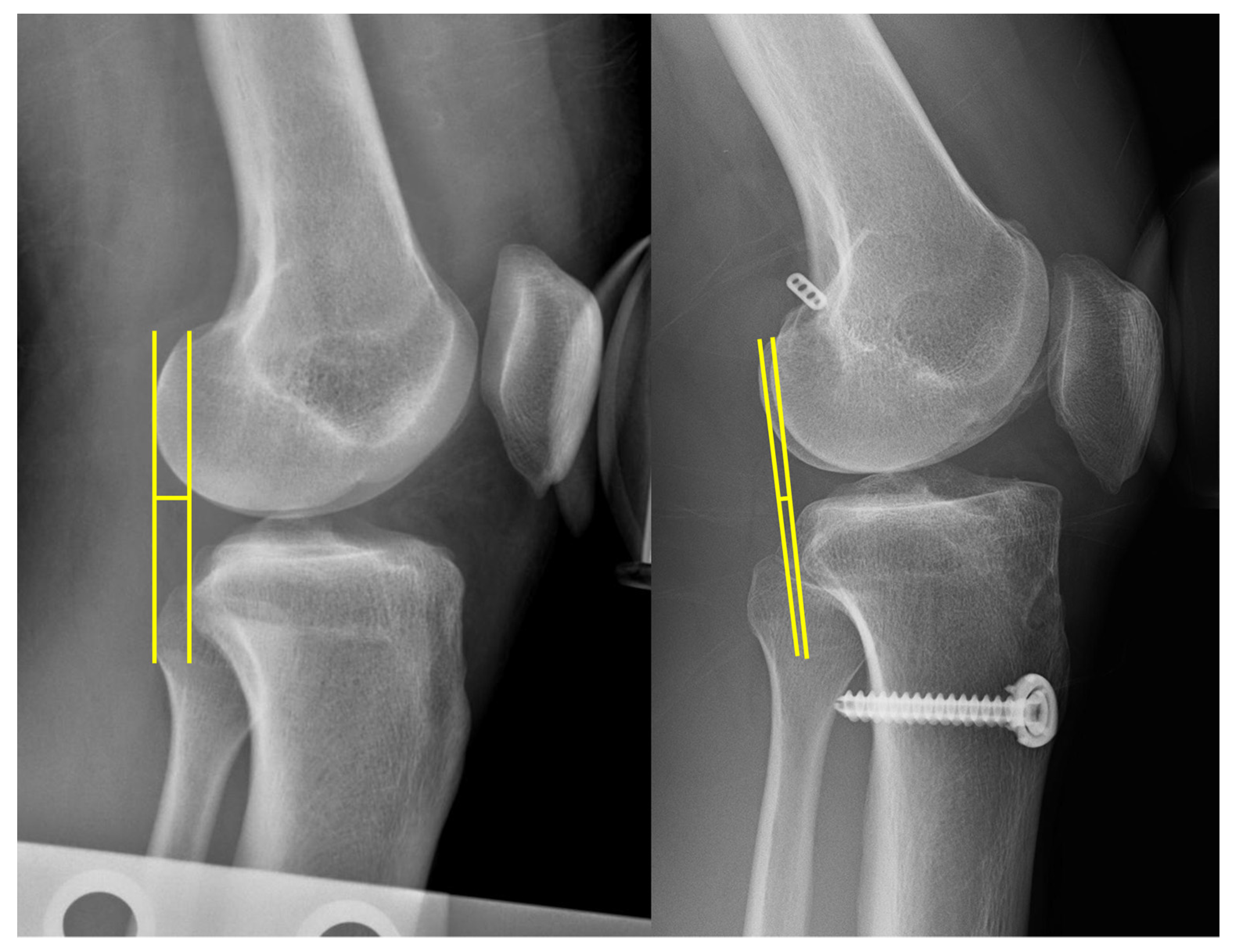 Medicina 58 01787 g005 Medicina 58 01787 g005