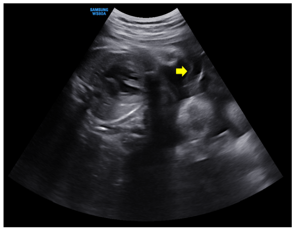 Medicina 58 01813 g001 550