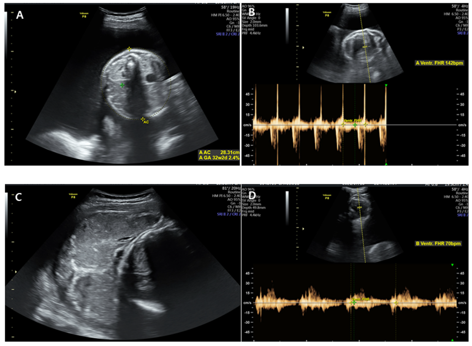 Medicina 58 01813 g002 550