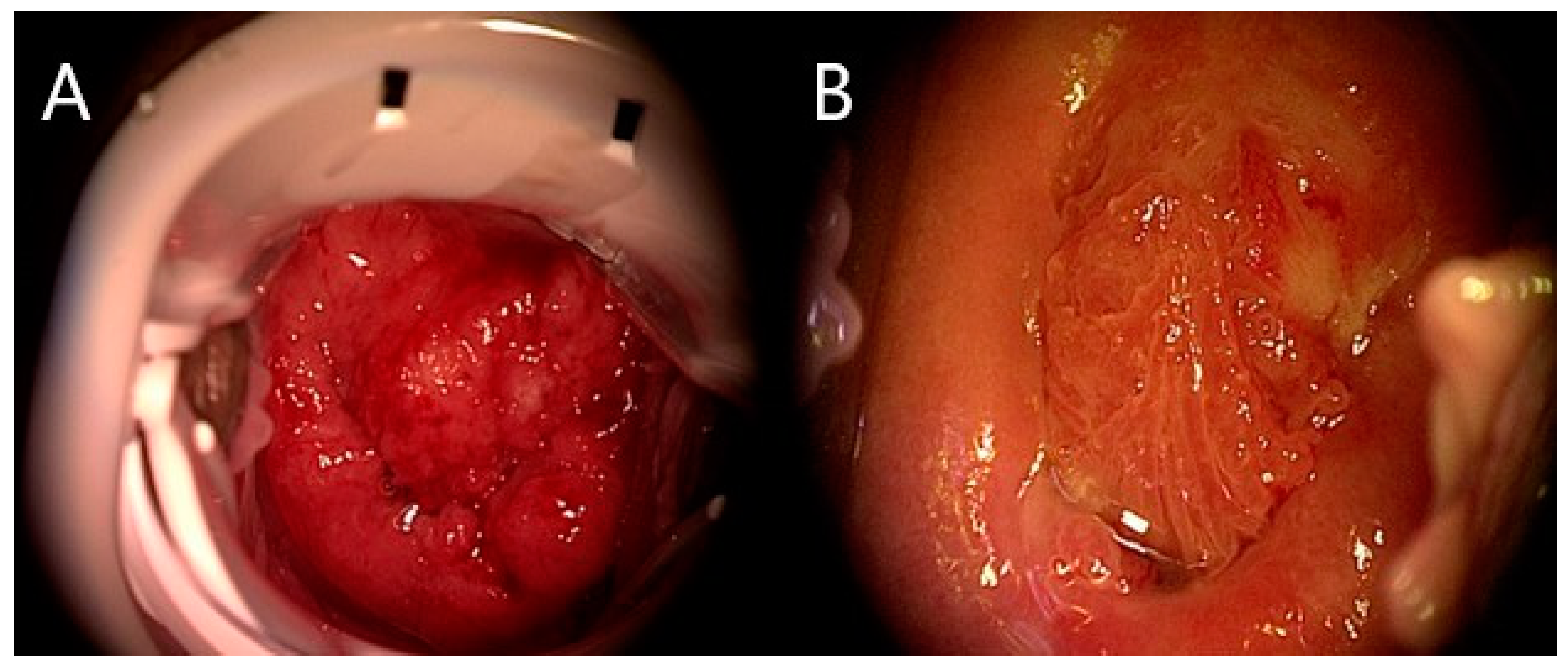Medicina 58 01827 g002