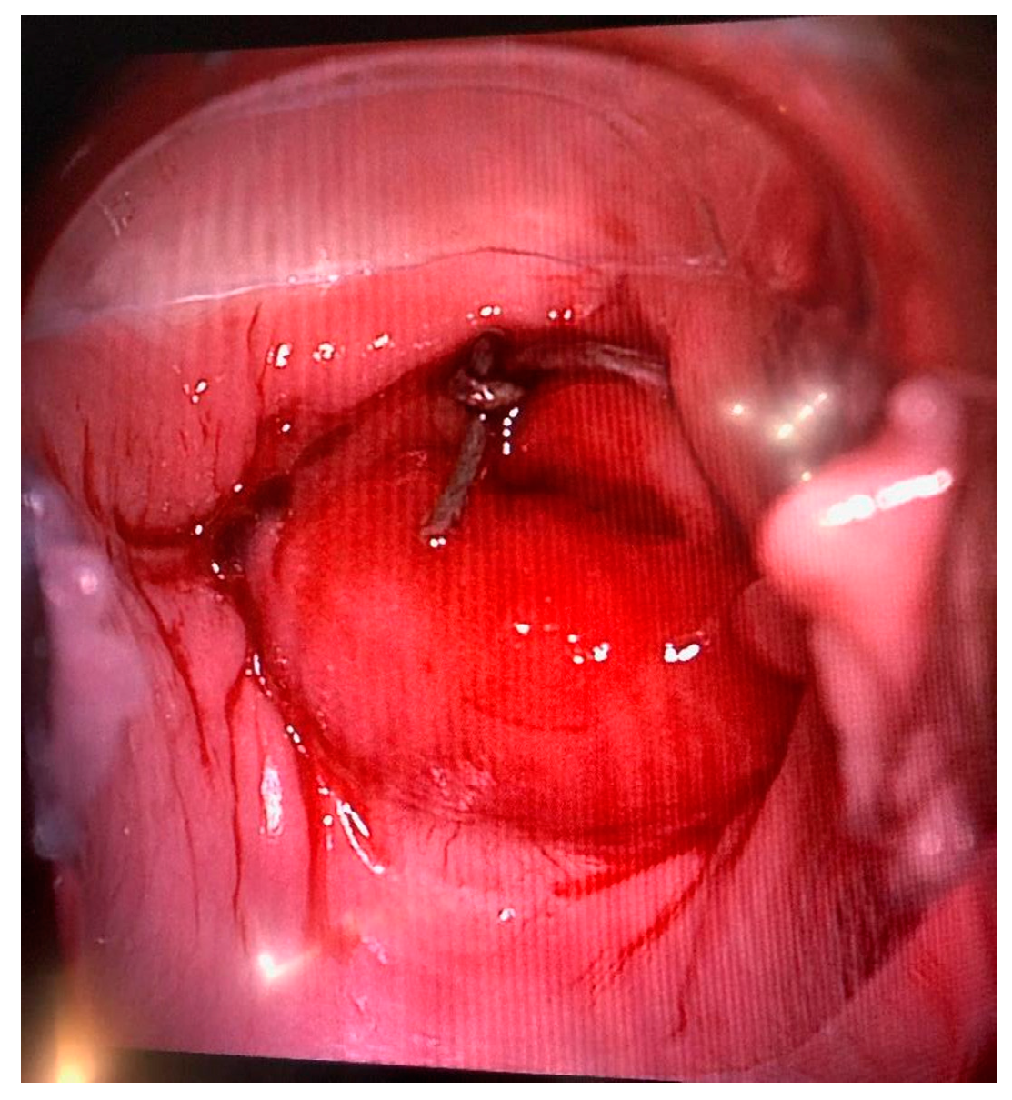 Medicina 58 01827 g003