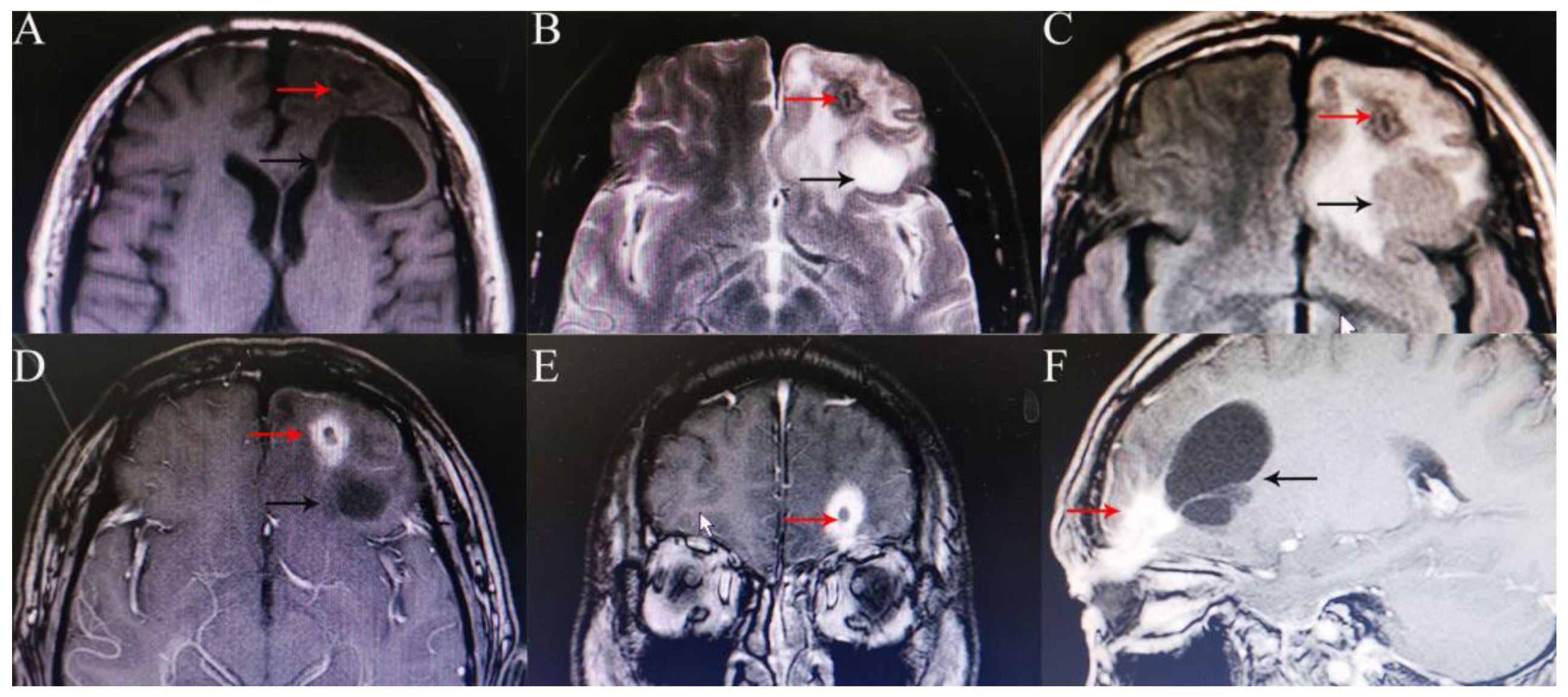 Medicina 58 01832 g003