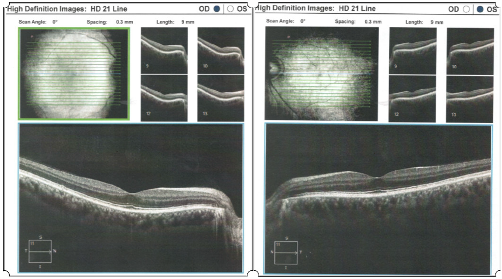 Medicina 58 01837 g004