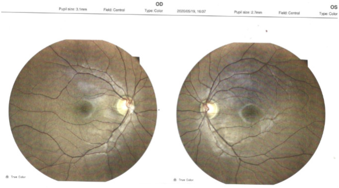 Medicina 58 01837 g005