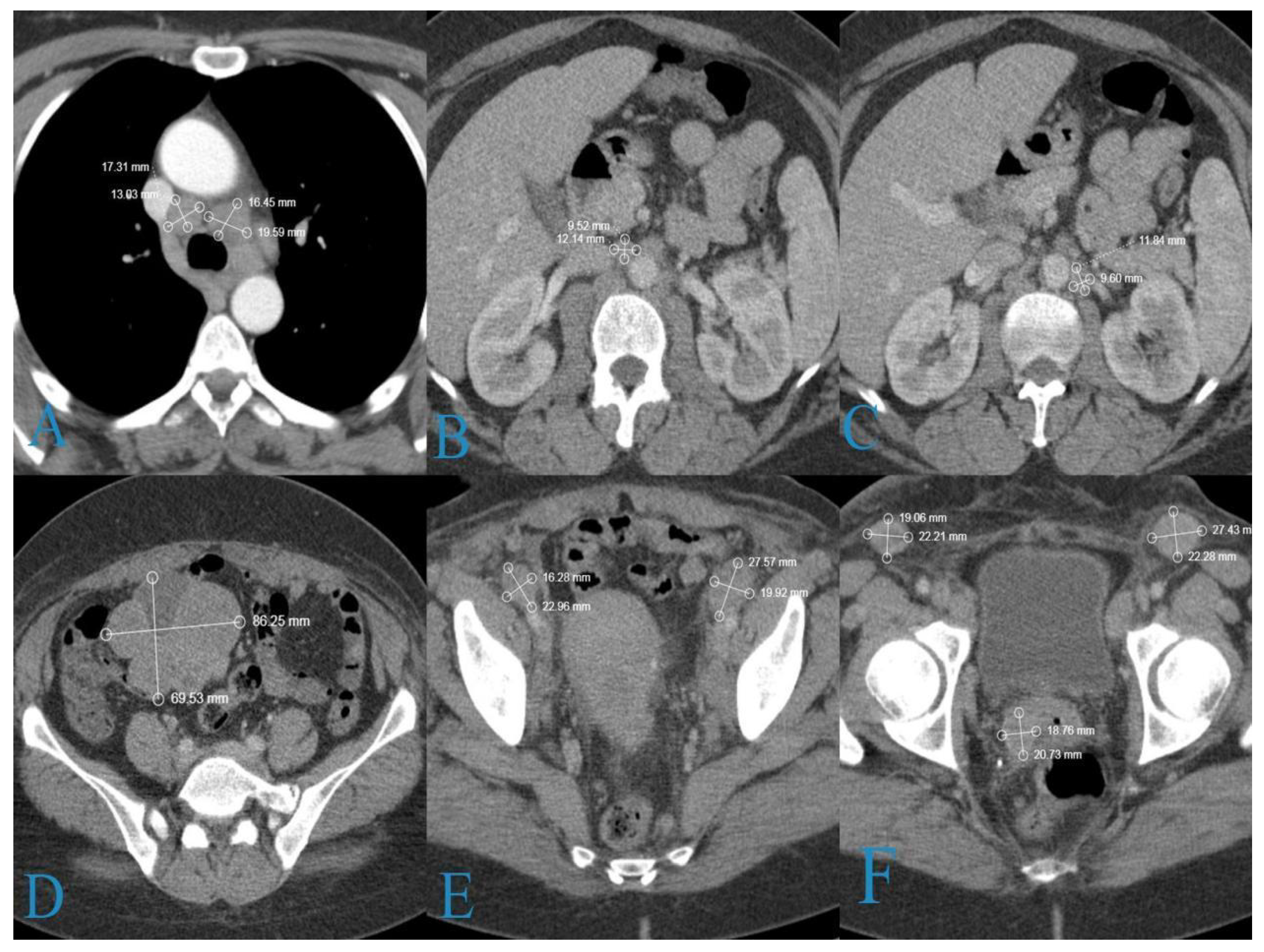 Medicina 58 01838 g003