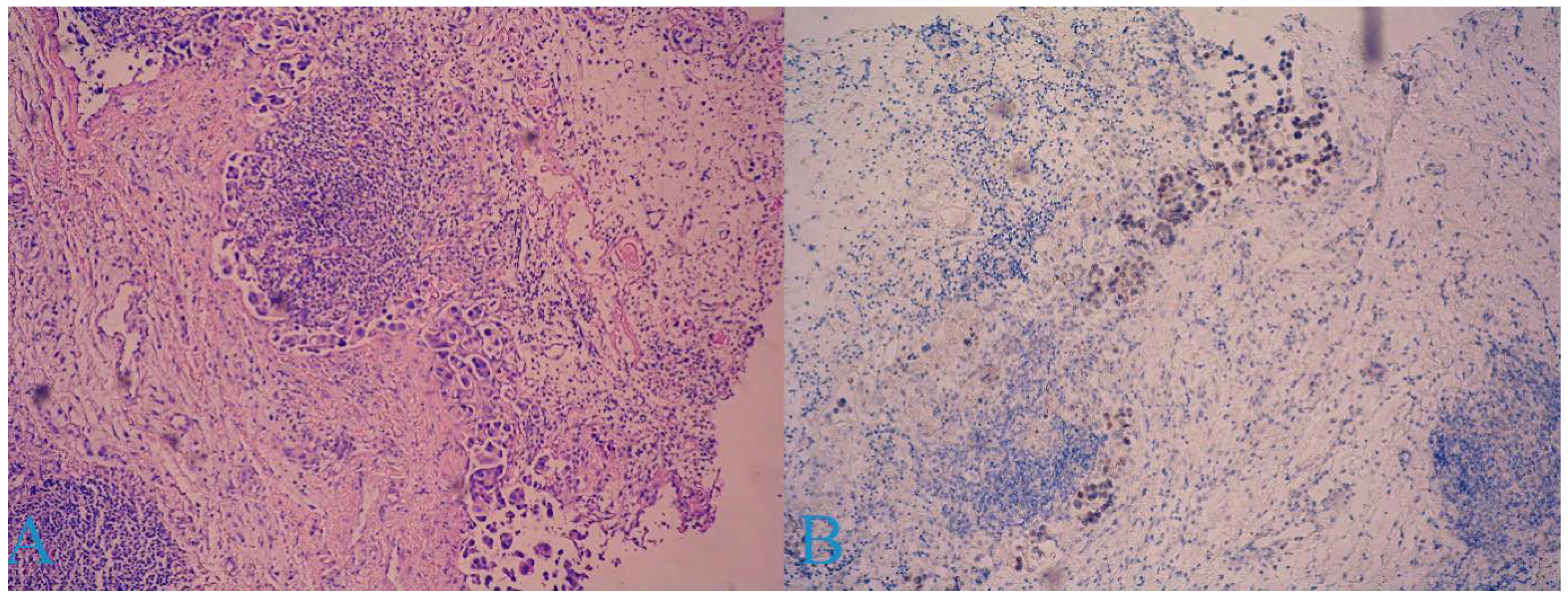 Medicina 58 01838 g004