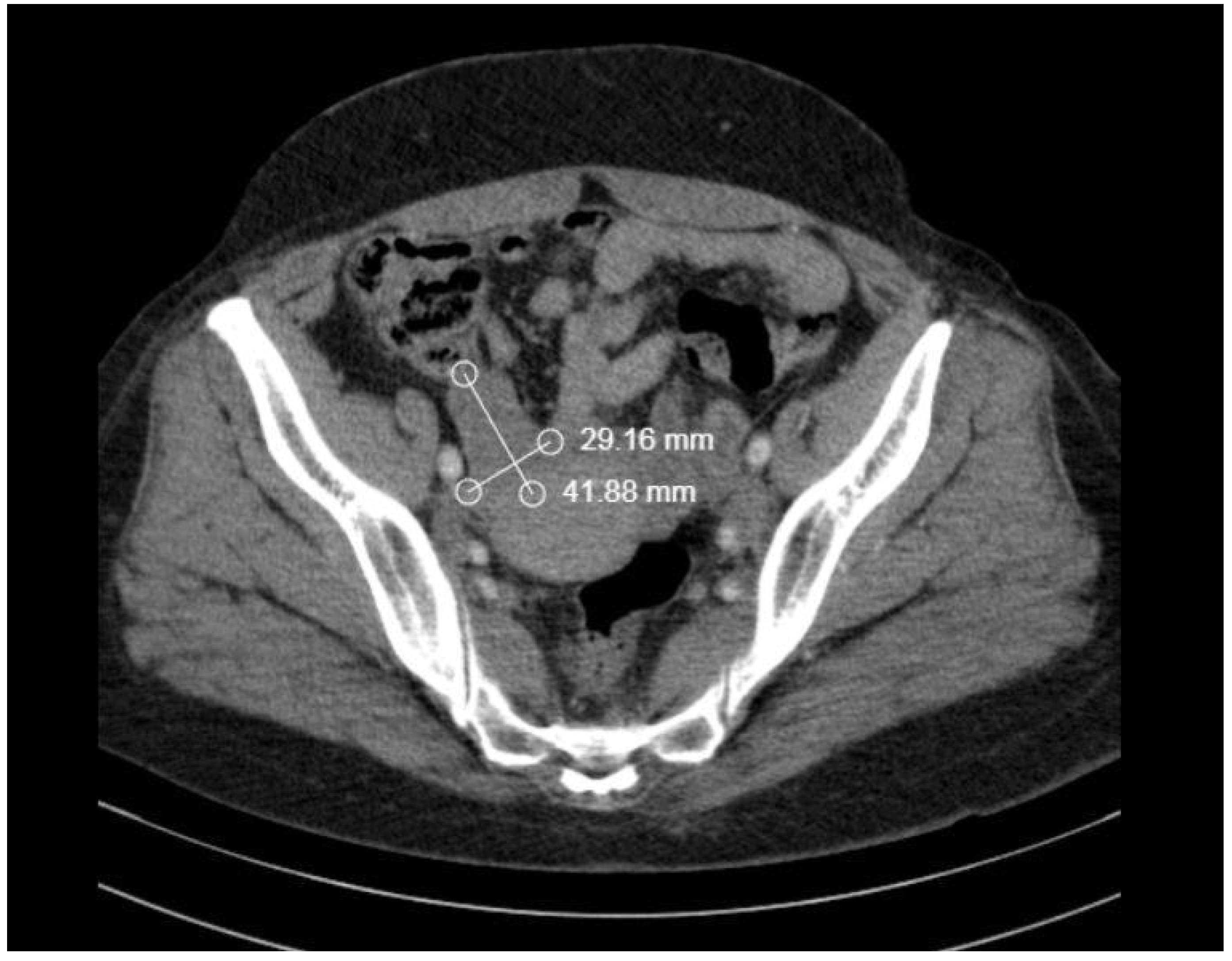 Medicina 58 01838 g006