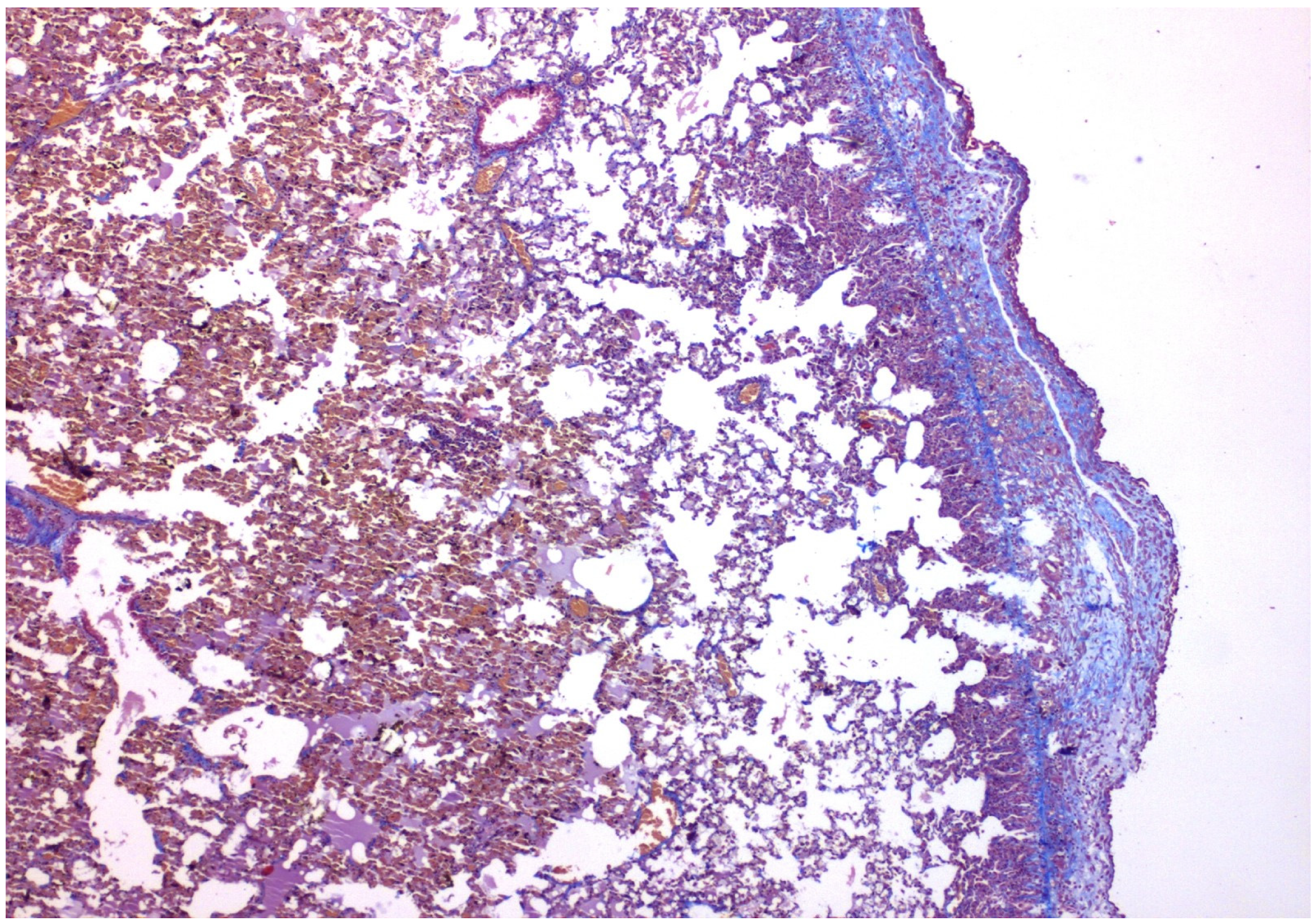 Medicina 58 01842 g002