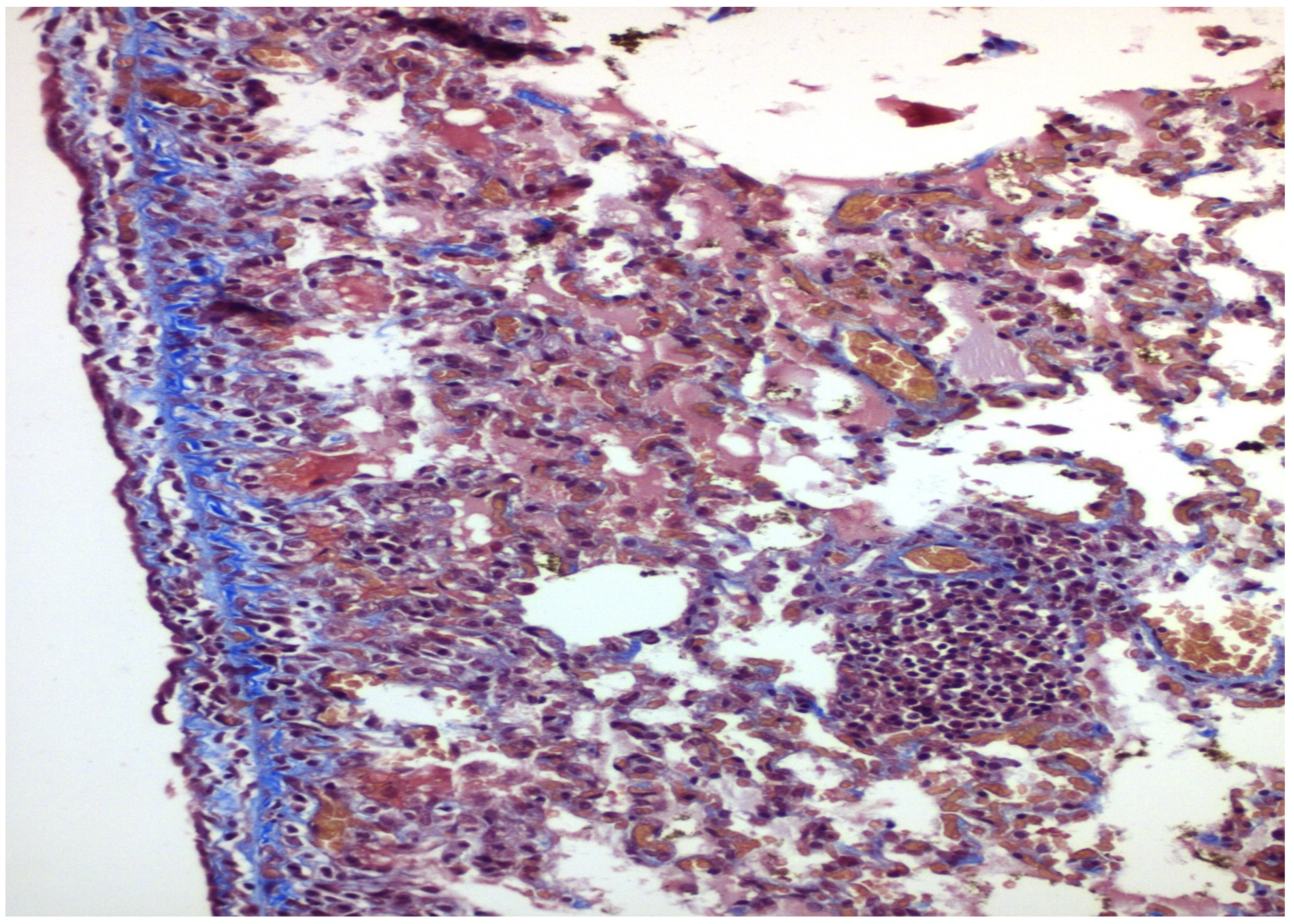 Medicina 58 01842 g004