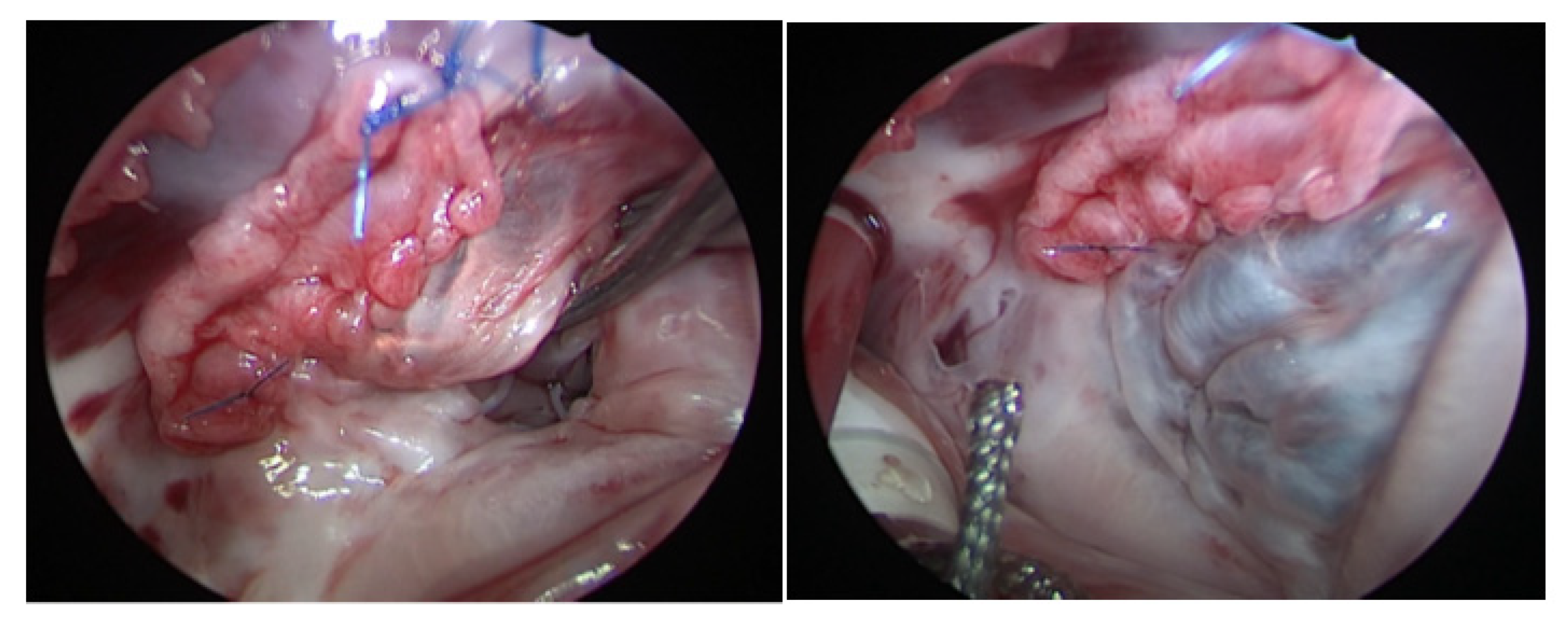 Medicina 58 01849 g003