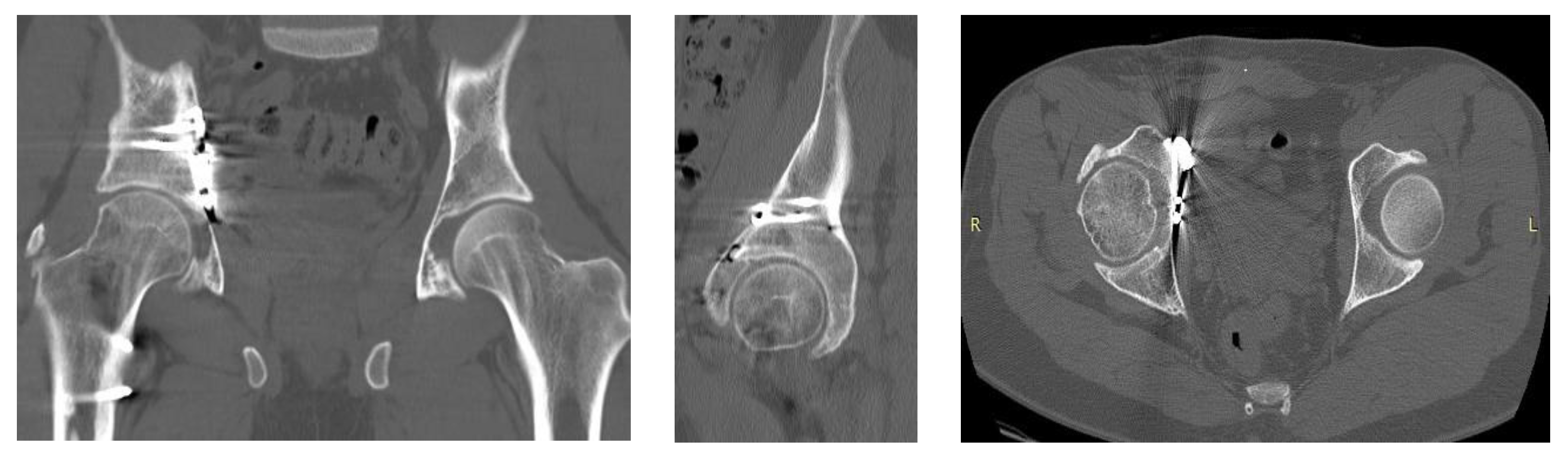 Medicina 58 01854 g004