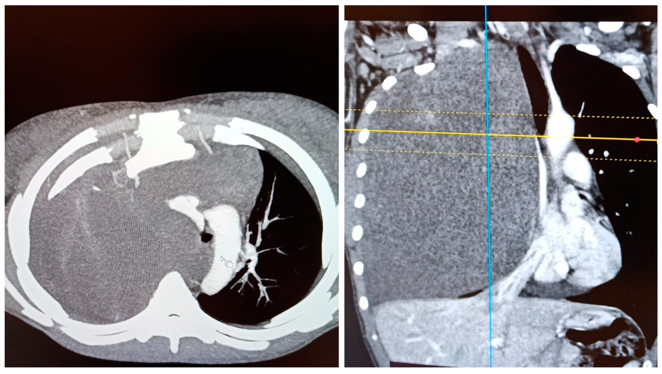Medicina 58 01857 g001