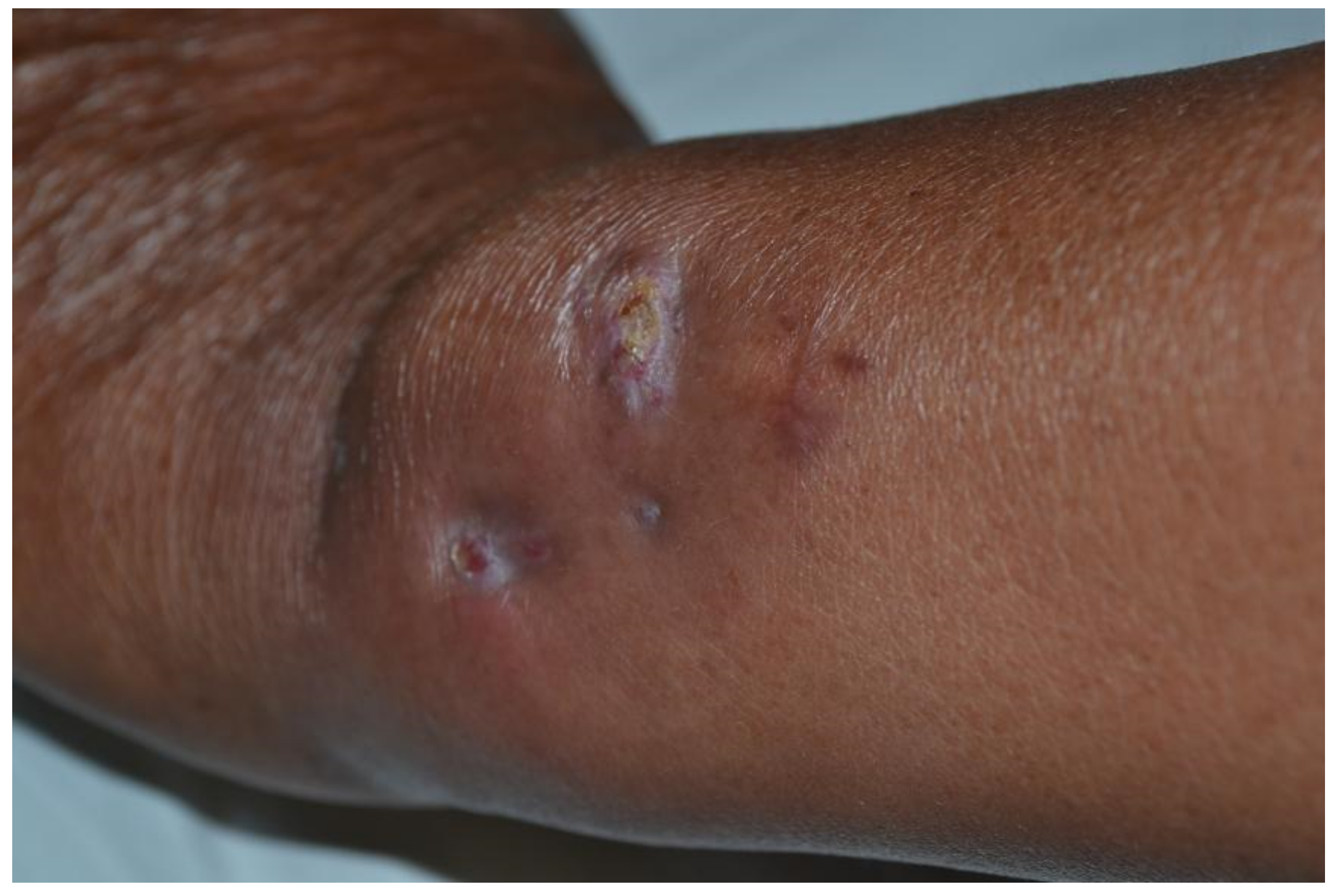 Medicina 58 01873 g004