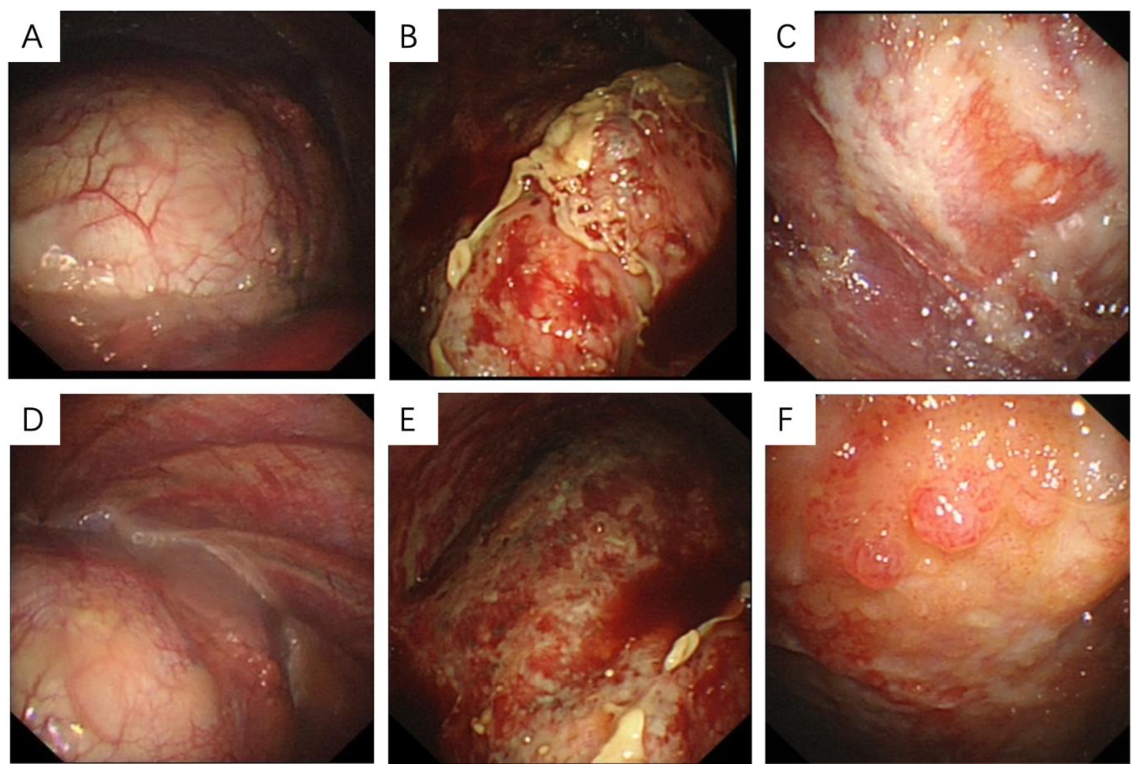 Medicina 58 01874 g002 Medicina 58 01874 g002