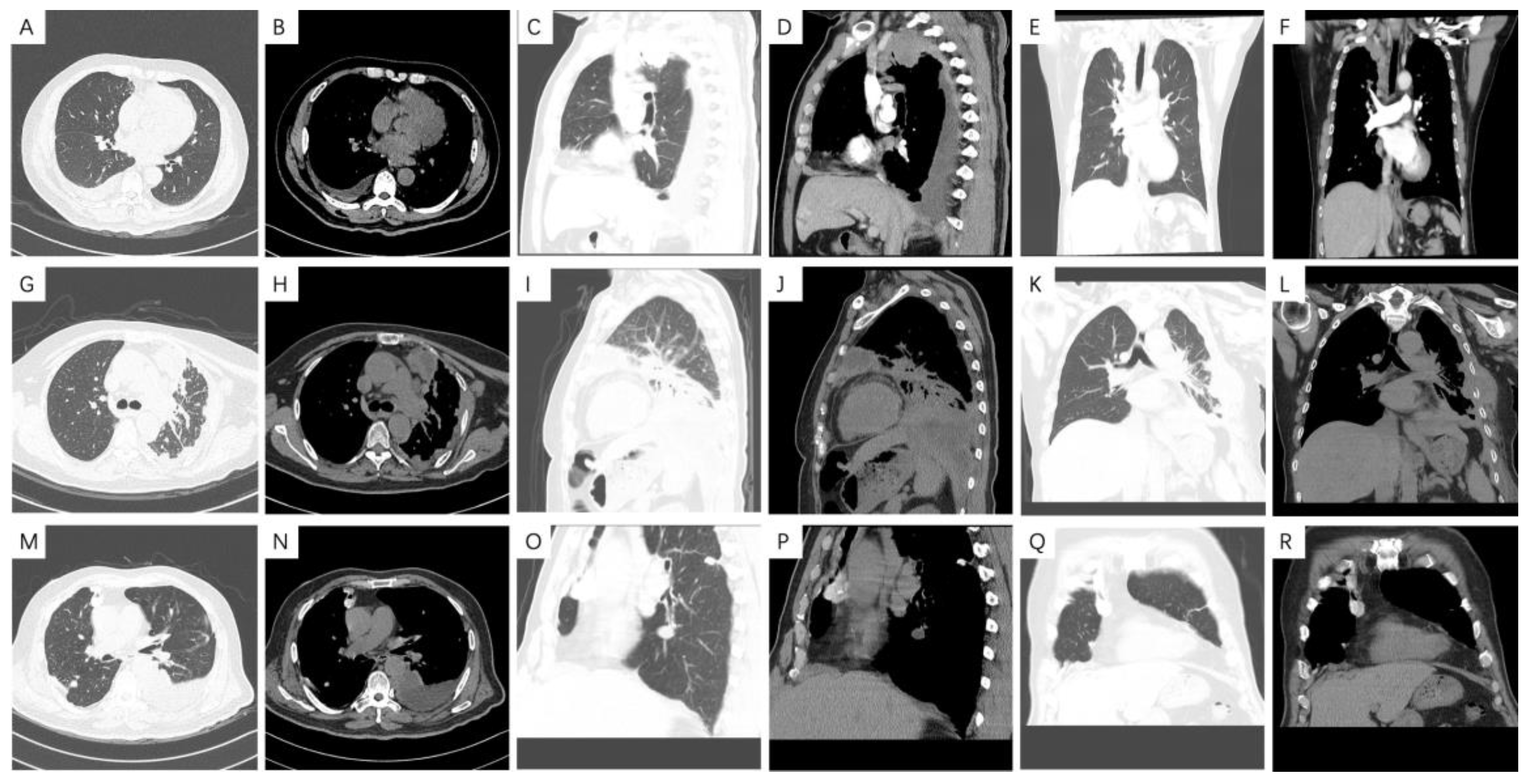 Medicina 58 01874 g006 Medicina 58 01874 g006
