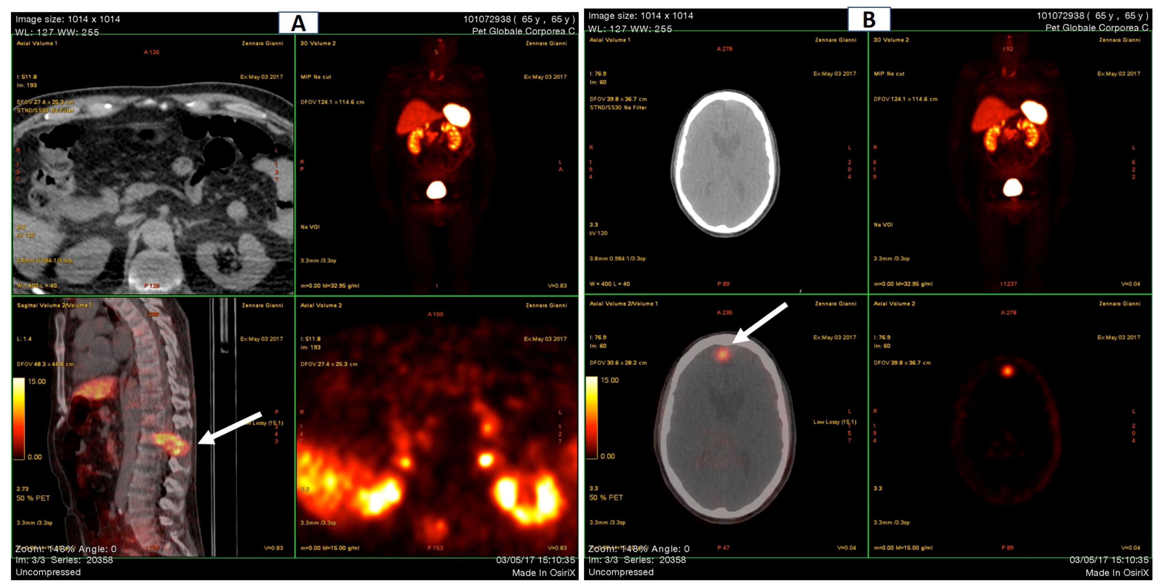Medicina 58 01875 g004