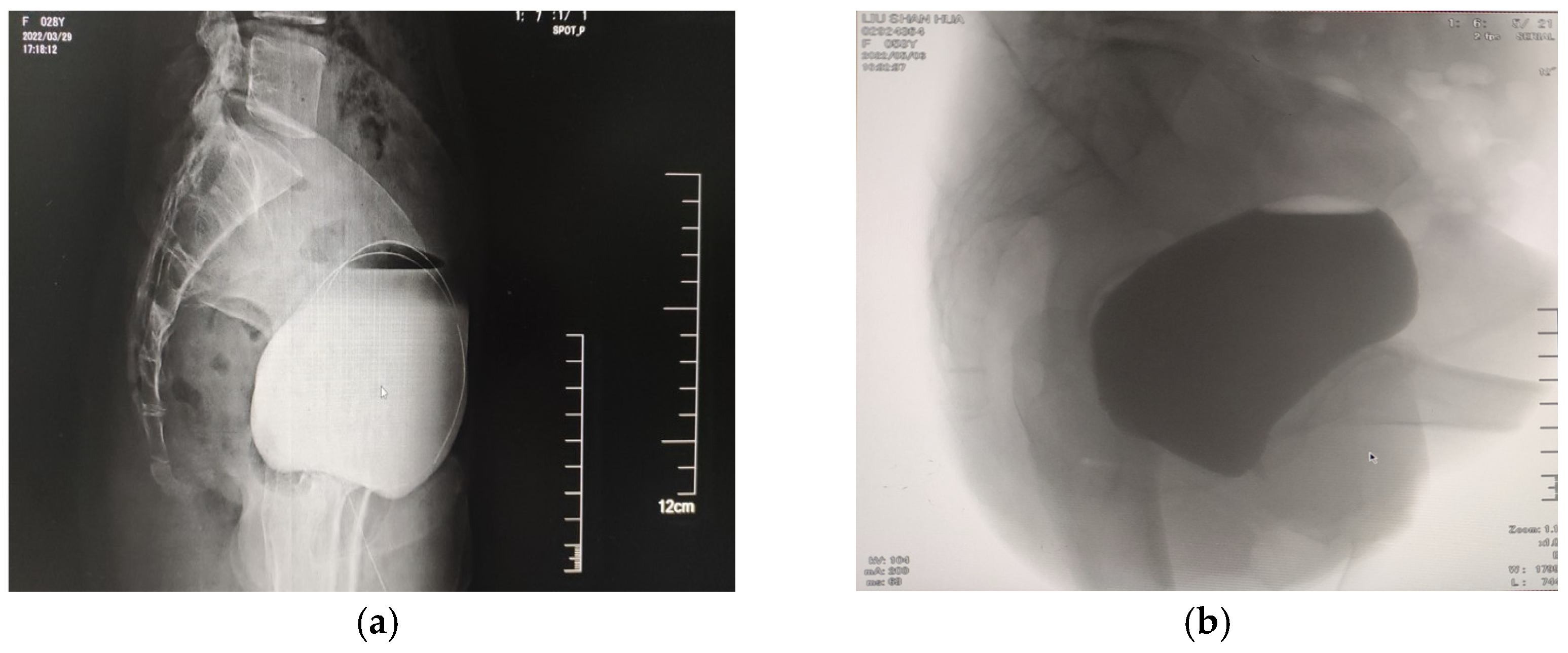 Medicina 59 00005 g003 Medicina 59 00005 g003