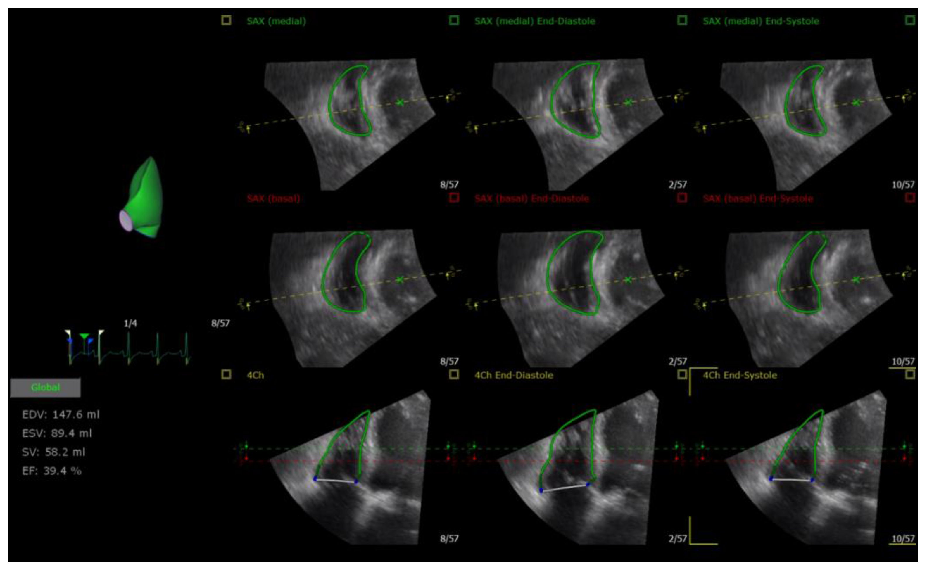 Medicina 59 00057 g002 Medicina 59 00057 g002