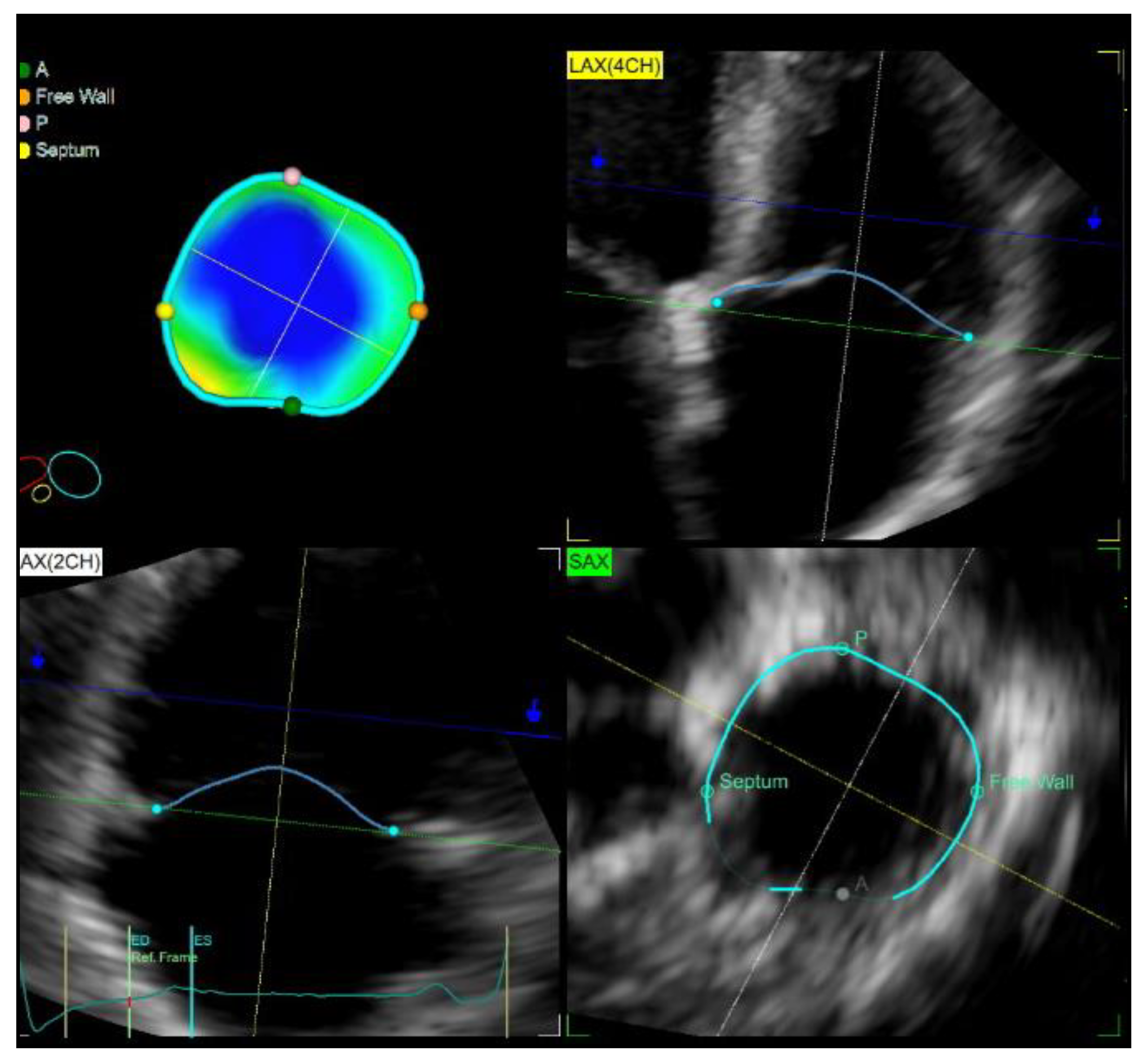 Medicina 59 00057 g003 Medicina 59 00057 g003