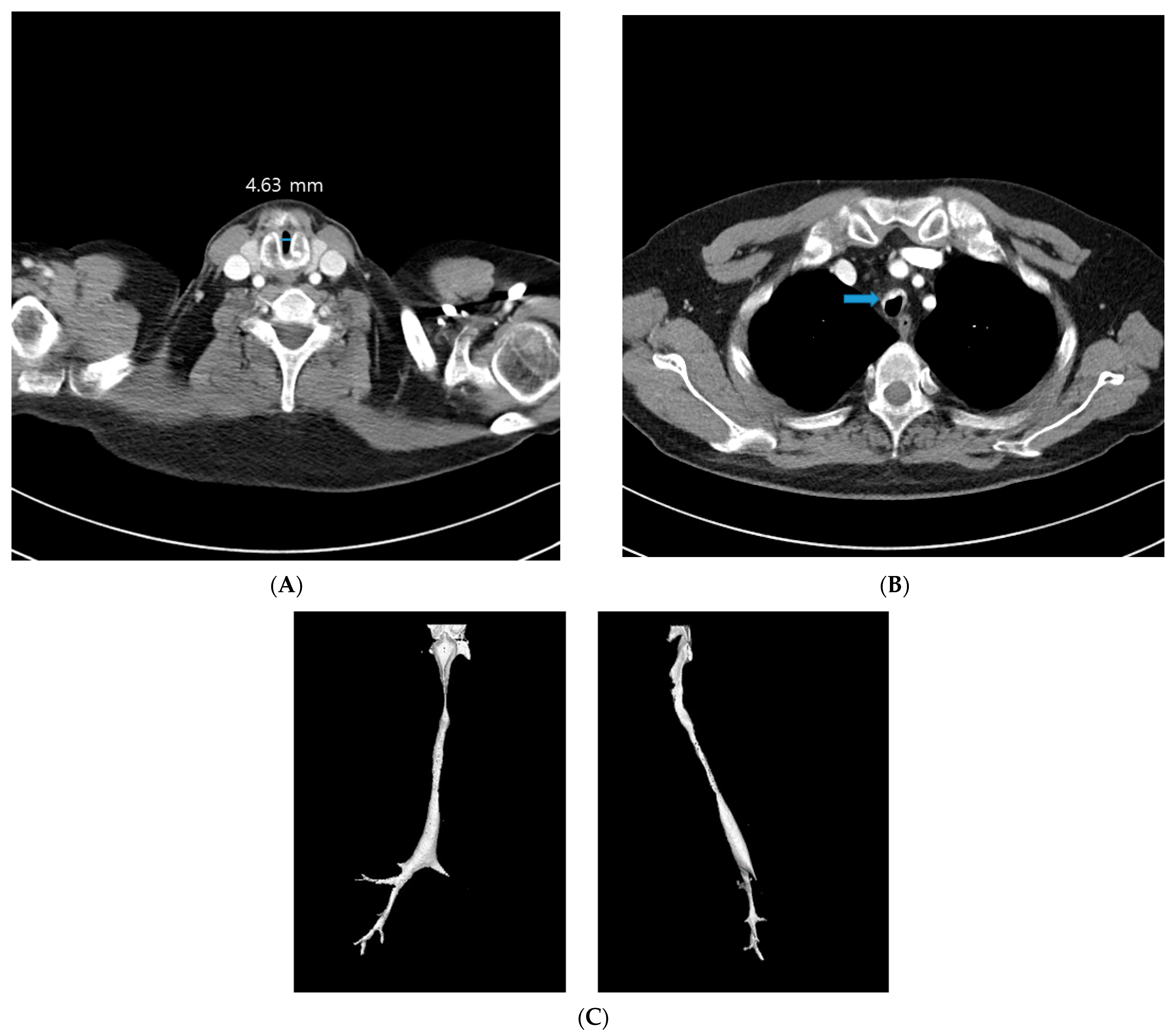 Medicina 59 00065 g002 Medicina 59 00065 g002