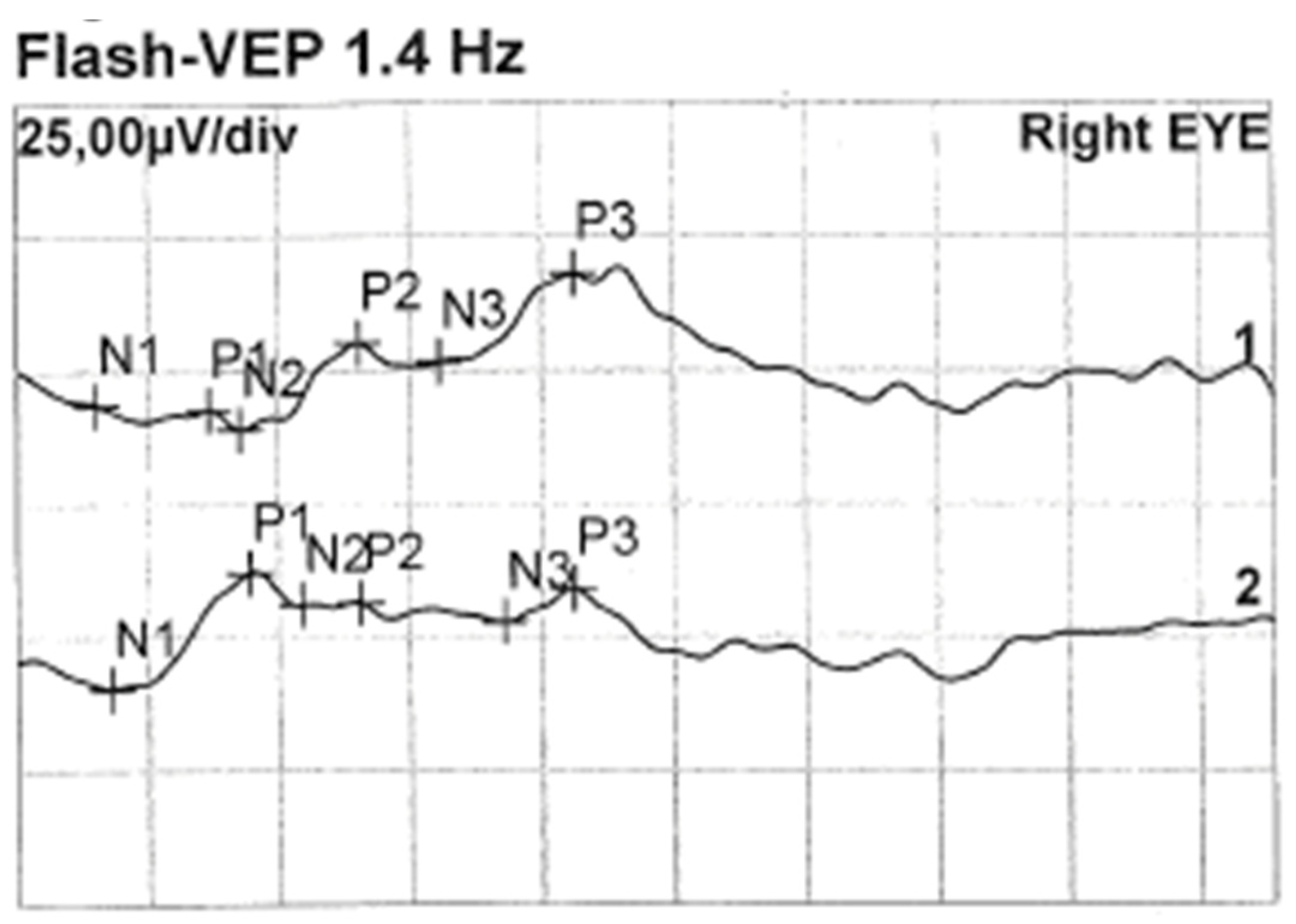 Medicina 59 00101 g004 Medicina 59 00101 g004