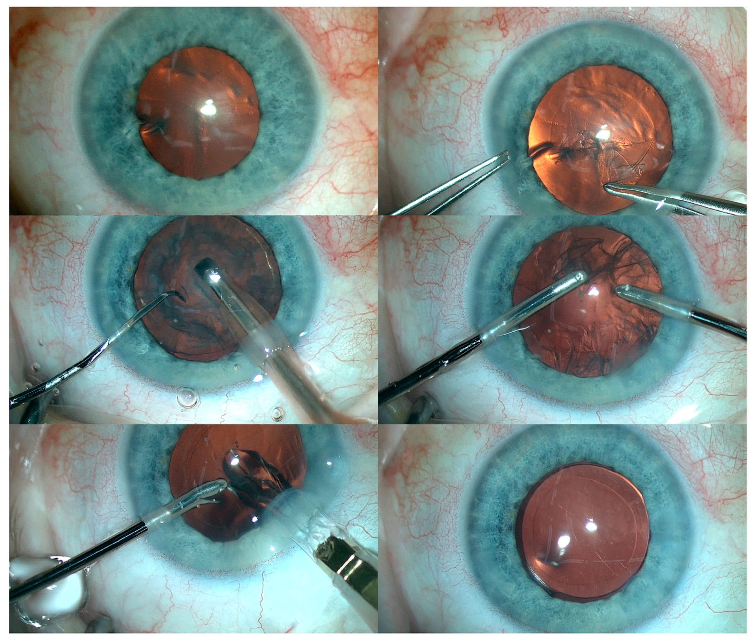 Medicina 59 00101 g005 Medicina 59 00101 g005