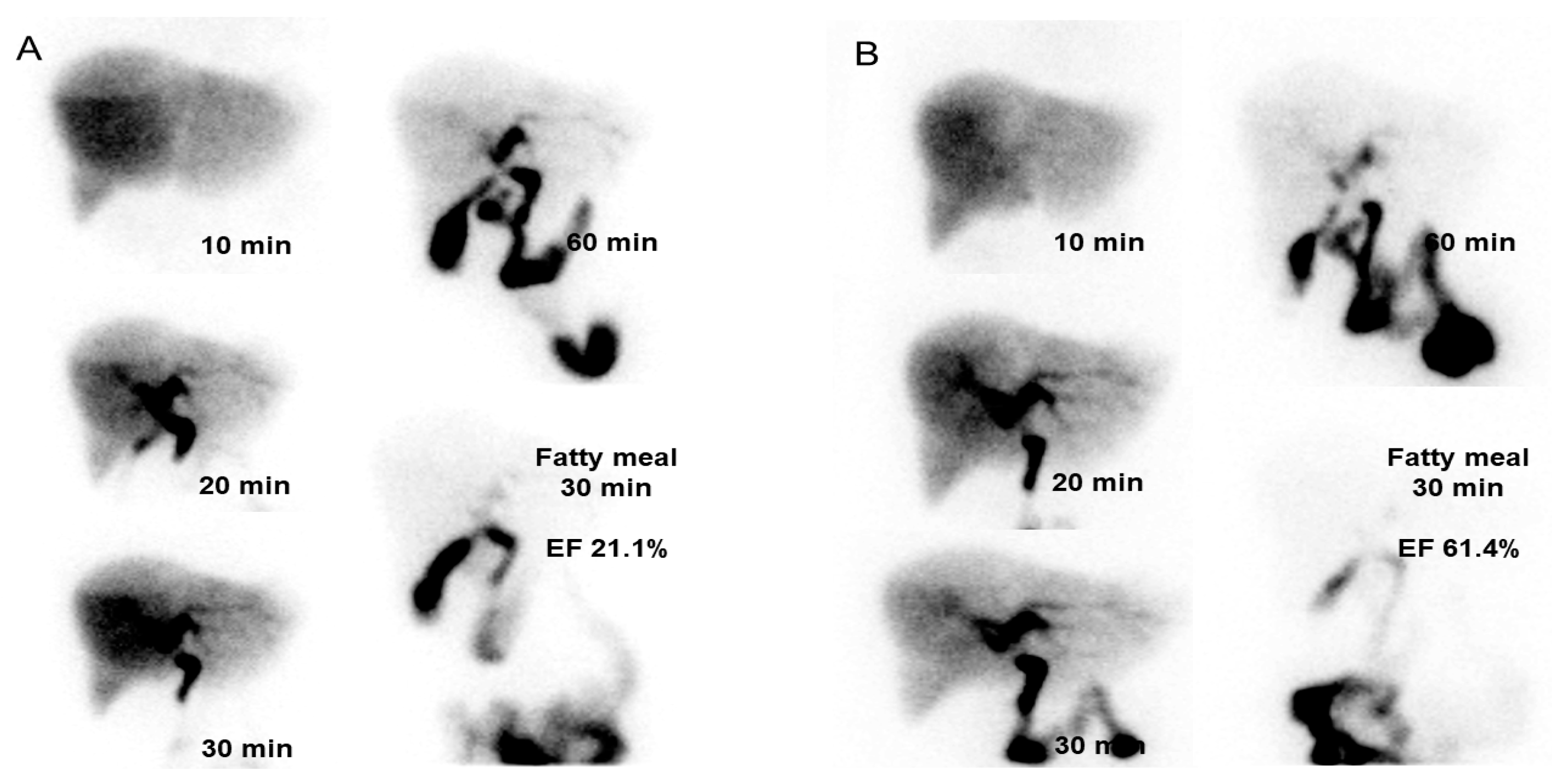 Medicina Free FullText Effect of Rowachol on the Gallbladder