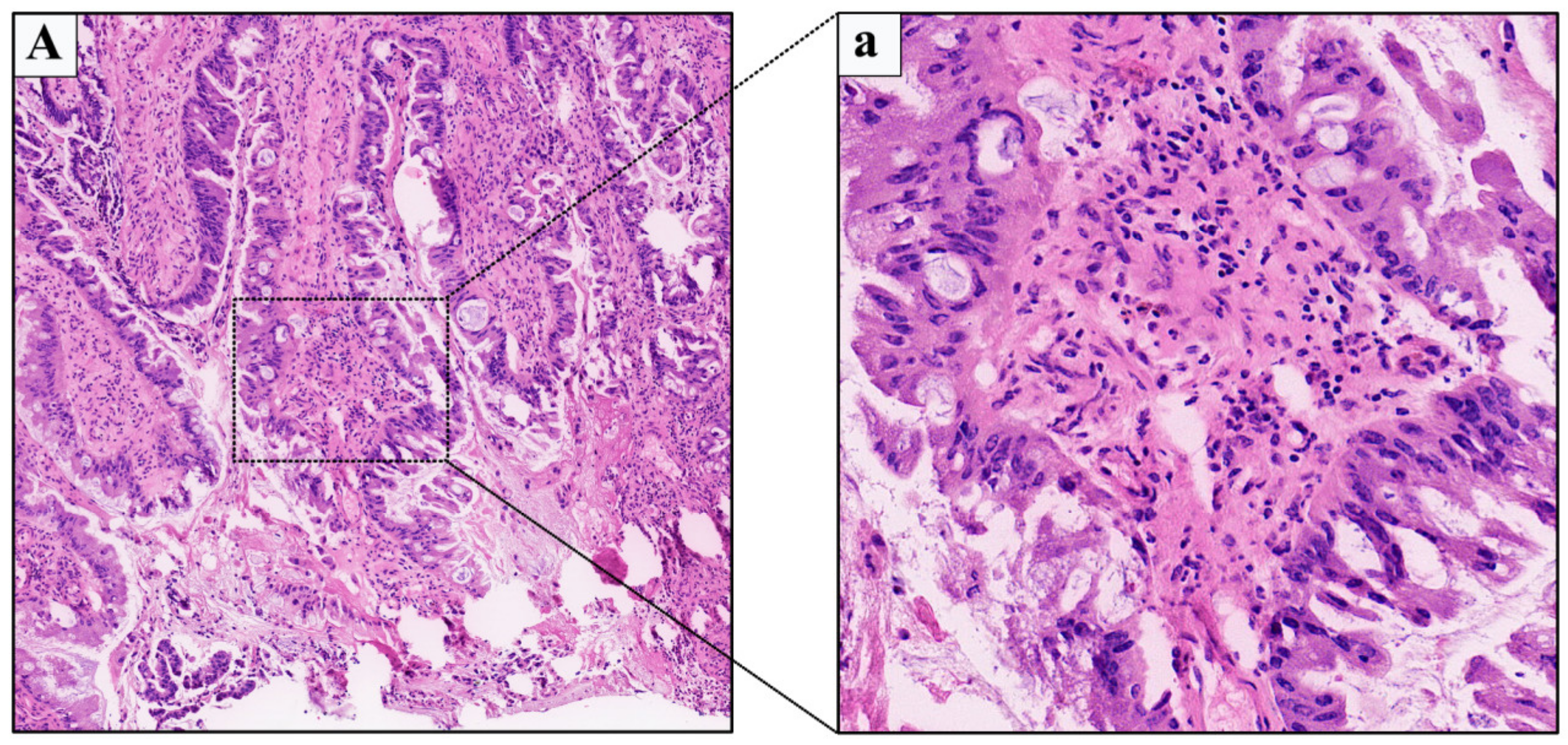 Medicina 59 00109 g002 Medicina 59 00109 g002