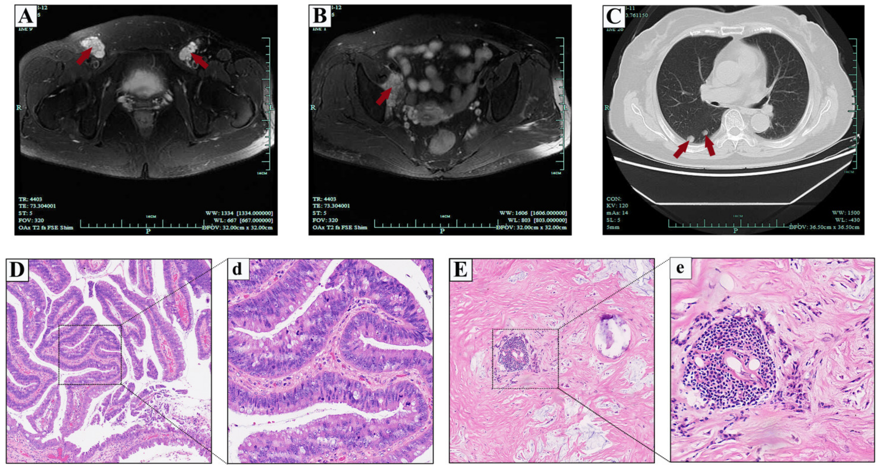 Medicina 59 00109 g004 Medicina 59 00109 g004