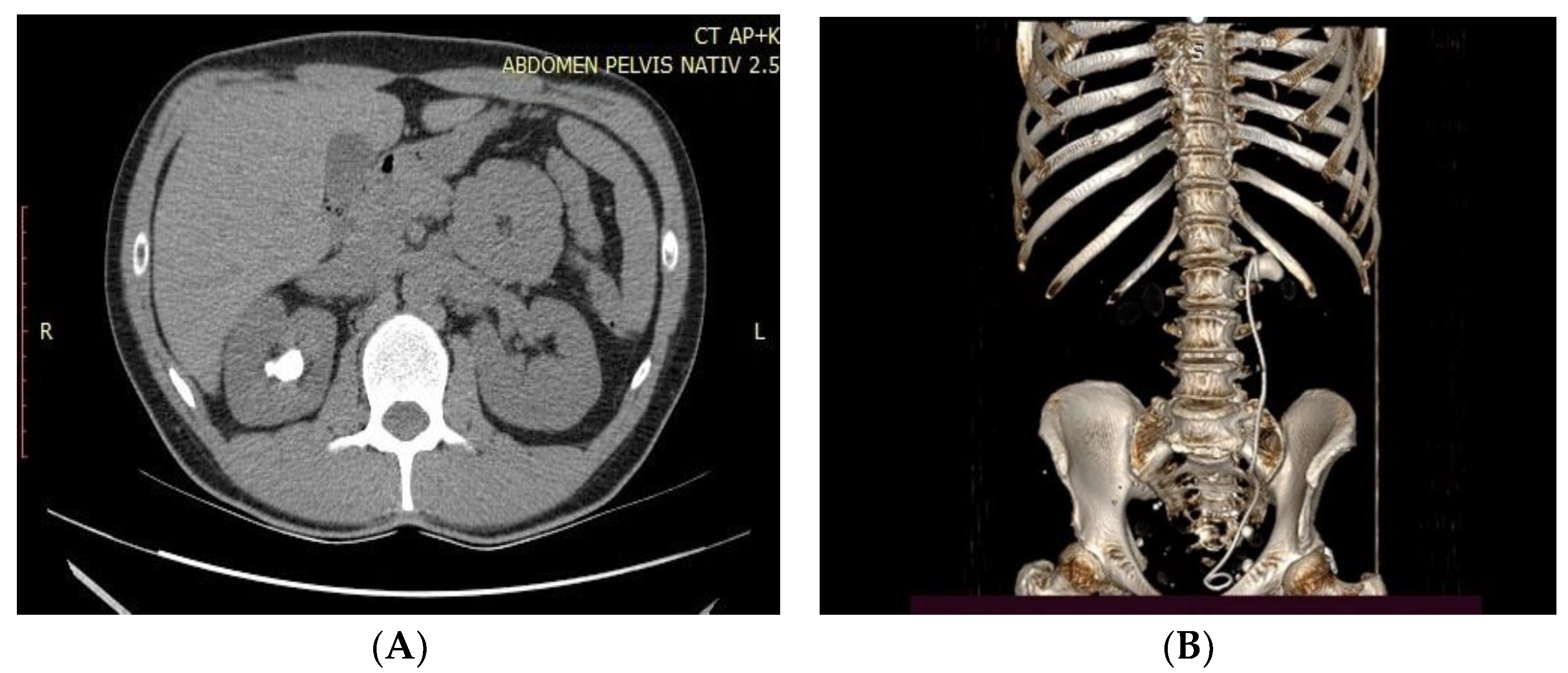 Medicina 59 00124 g001