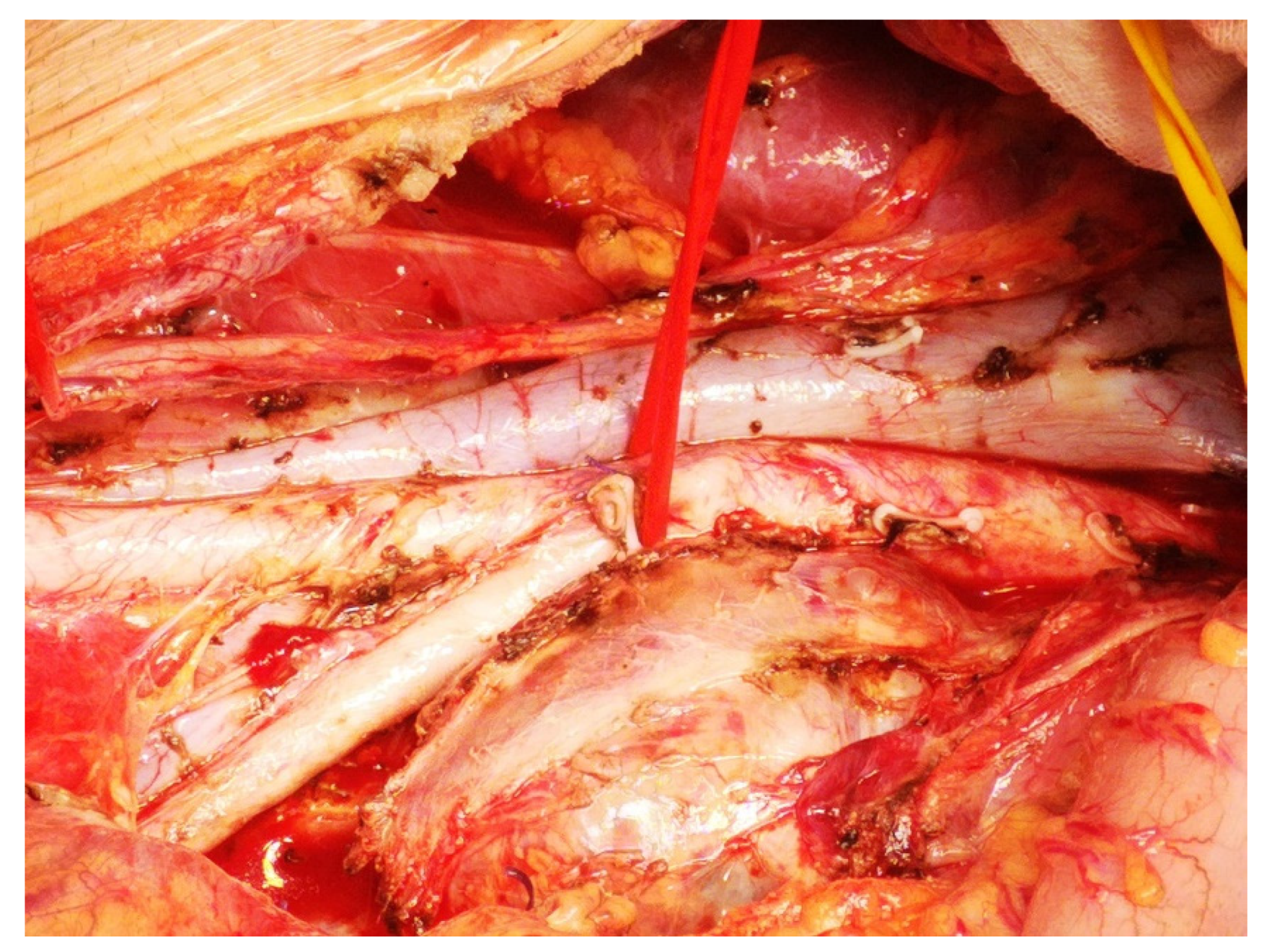 Medicina 59 00133 g004