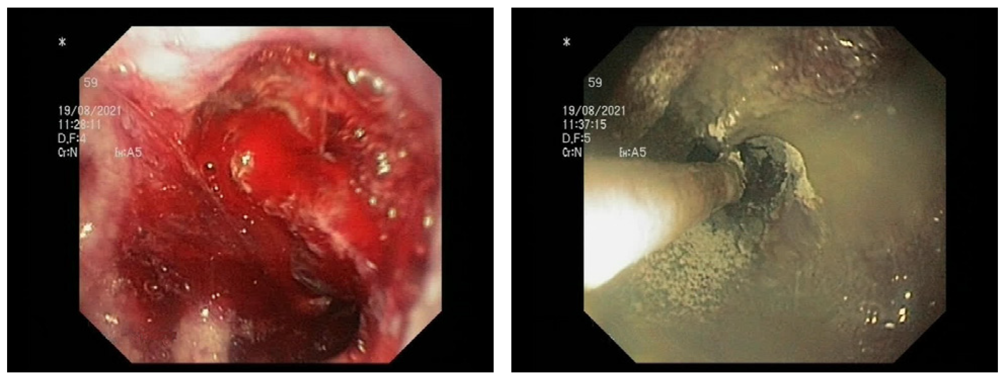 Medicina 59 00143 g001 Medicina 59 00143 g001