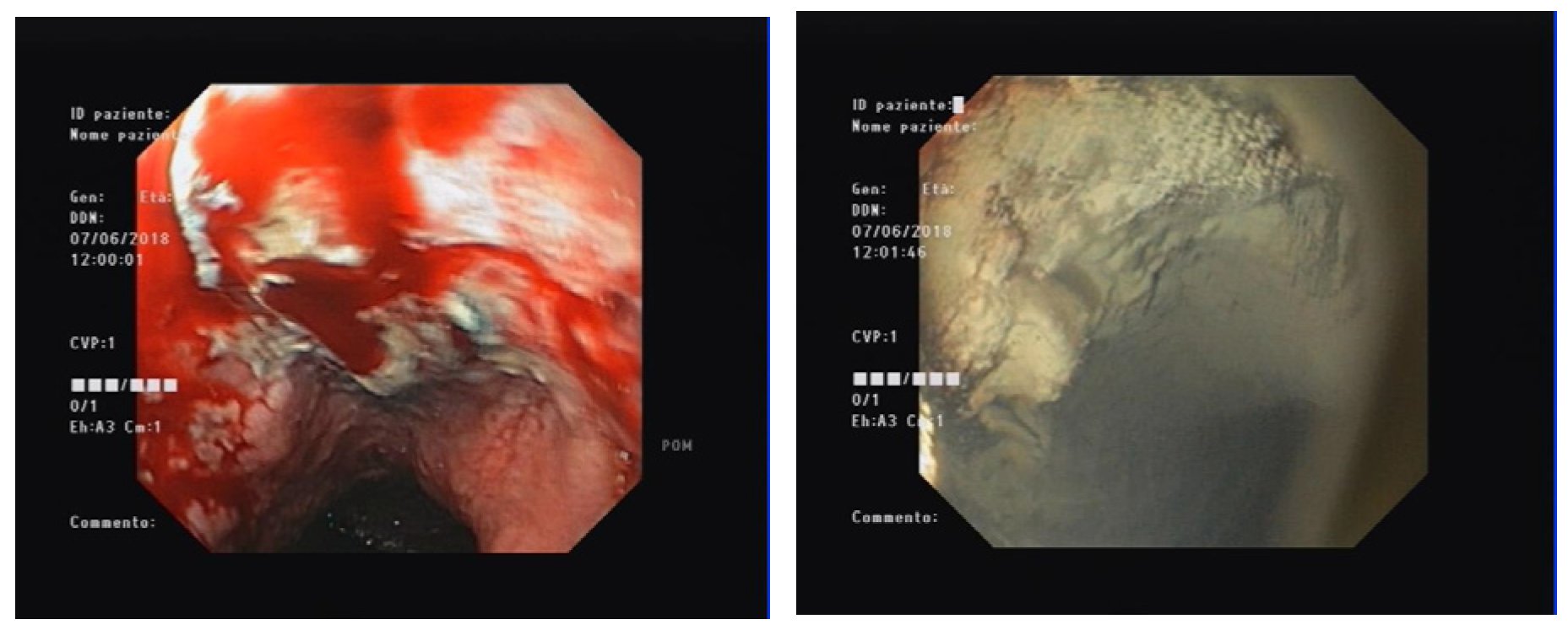 Medicina 59 00143 g002 Medicina 59 00143 g002