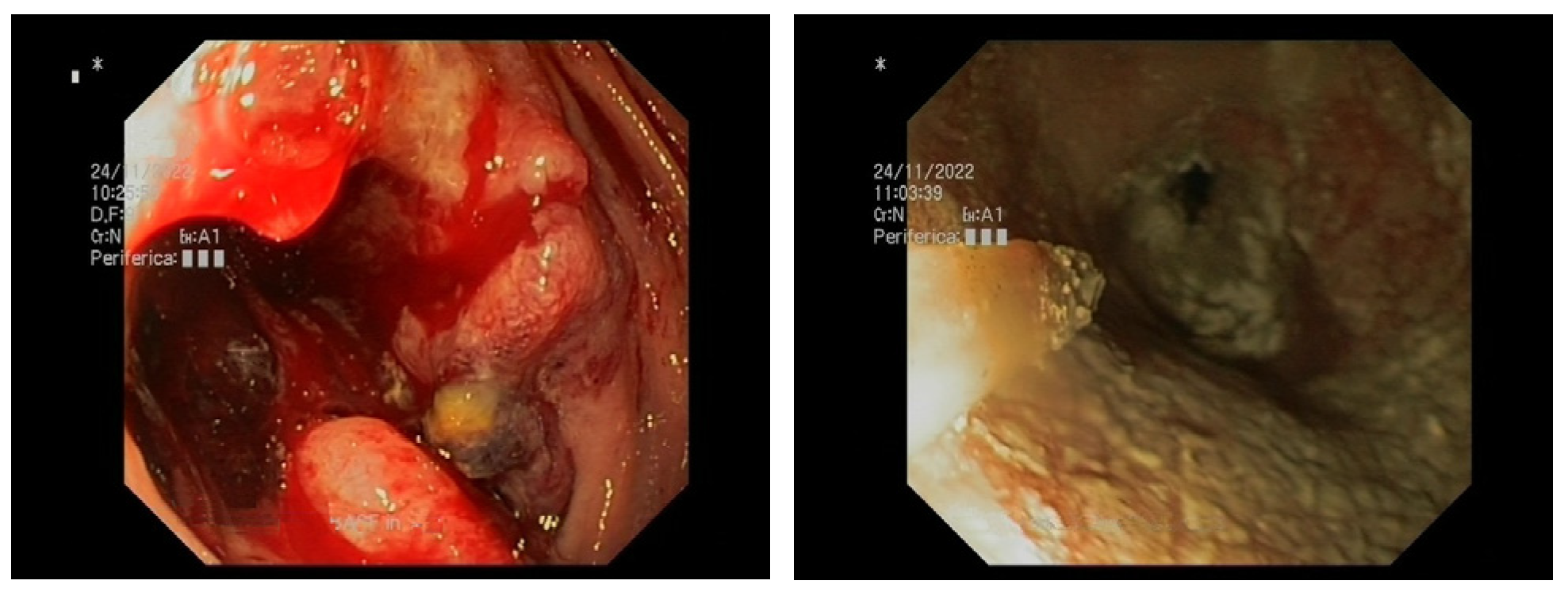 Medicina 59 00143 g003 Medicina 59 00143 g003