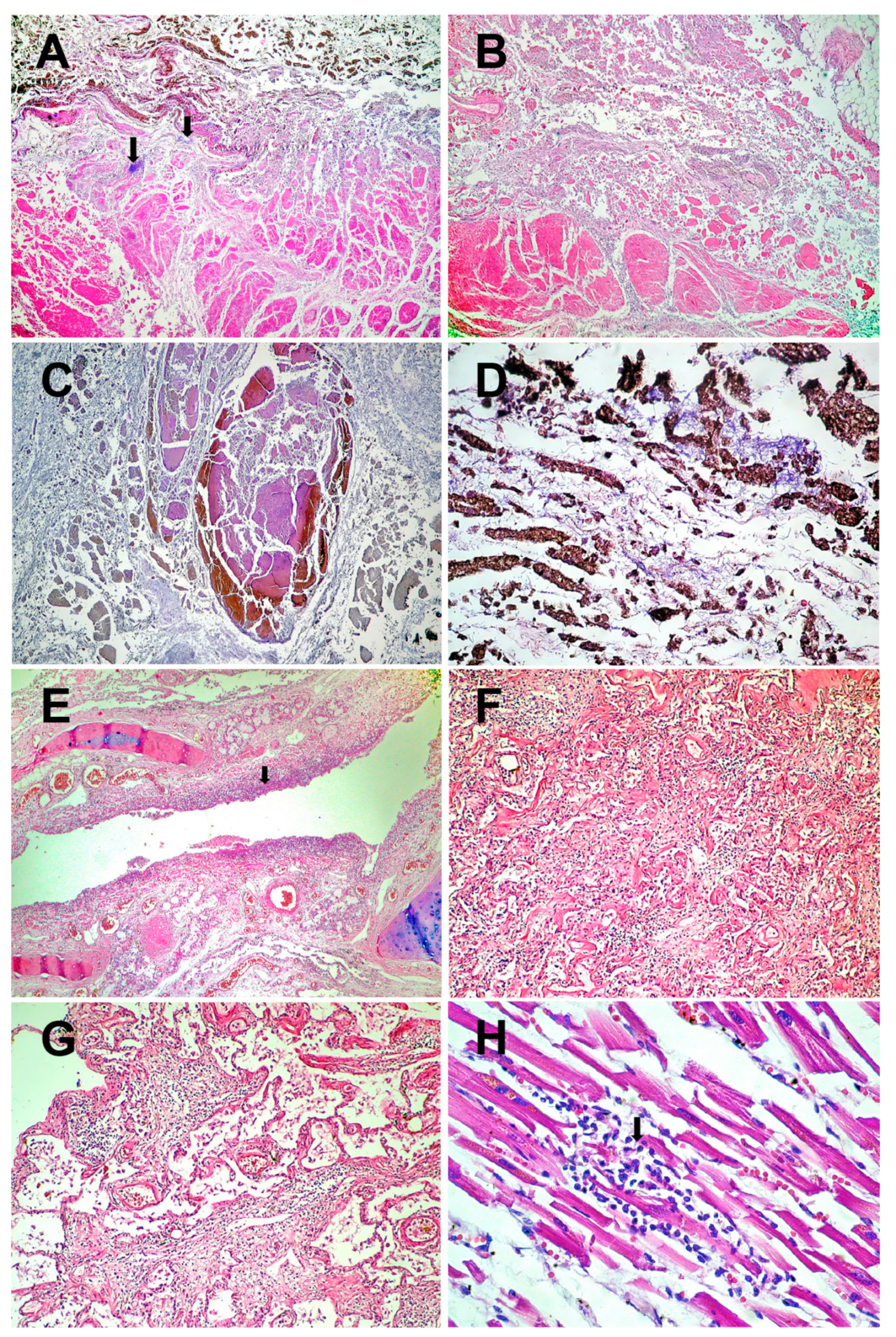 Medicina 59 00154 g002a