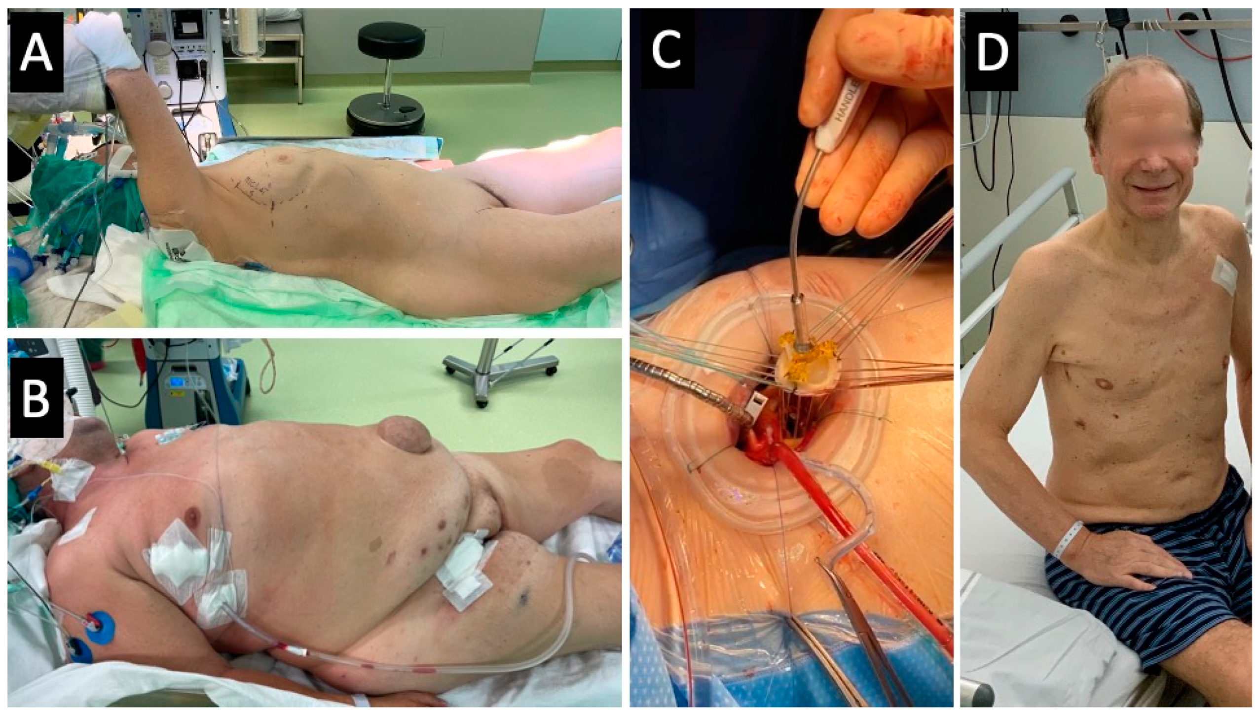 Medicina 59 00160 g002 Medicina 59 00160 g002