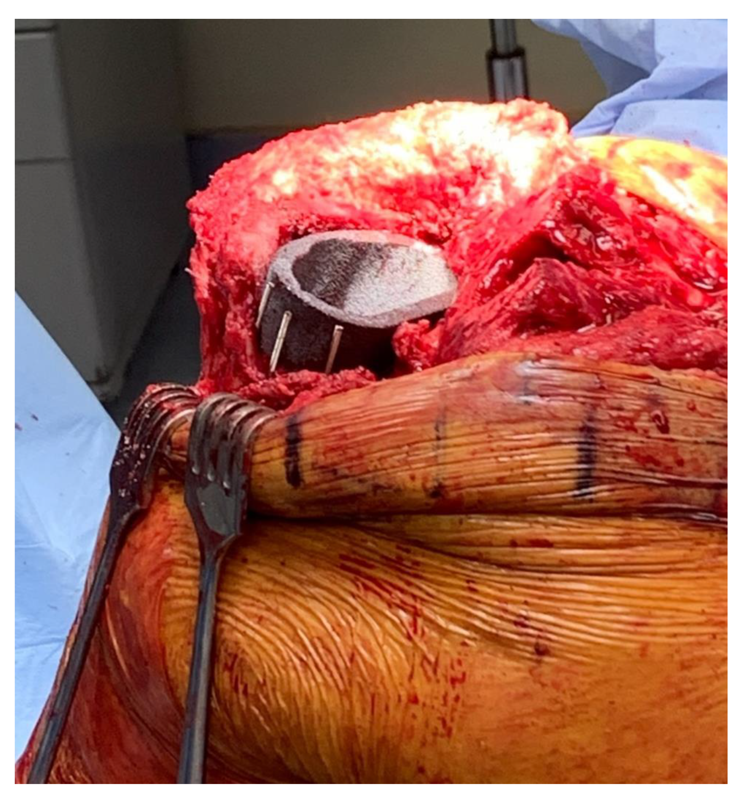 Medicina 59 00162 g003 Medicina 59 00162 g003