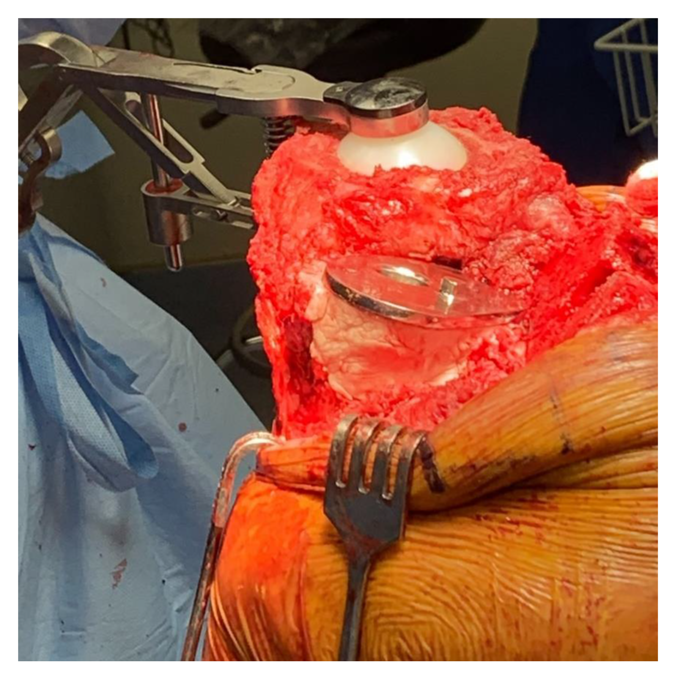 Medicina 59 00162 g004 Medicina 59 00162 g004