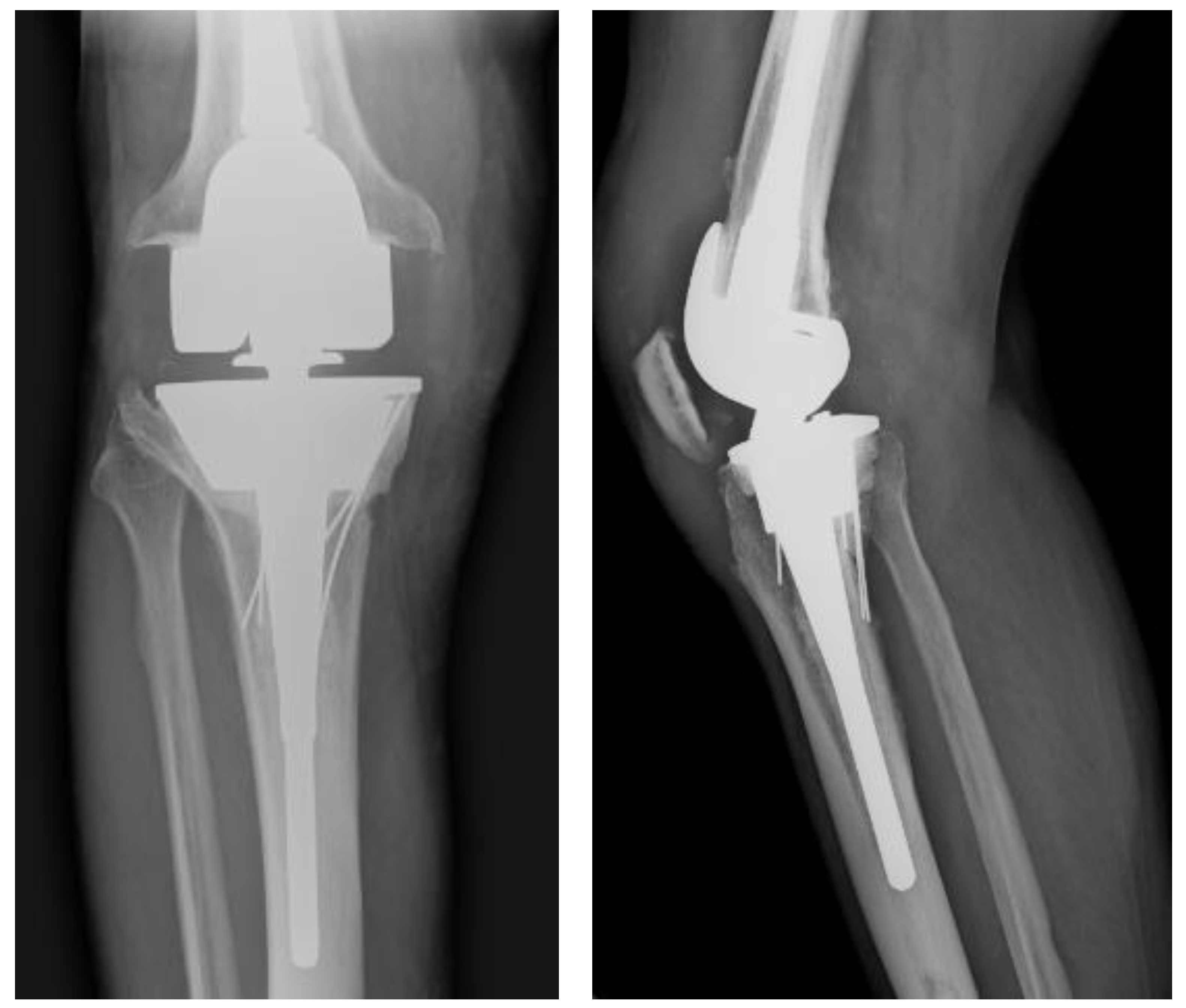 Medicina 59 00162 g005 Medicina 59 00162 g005