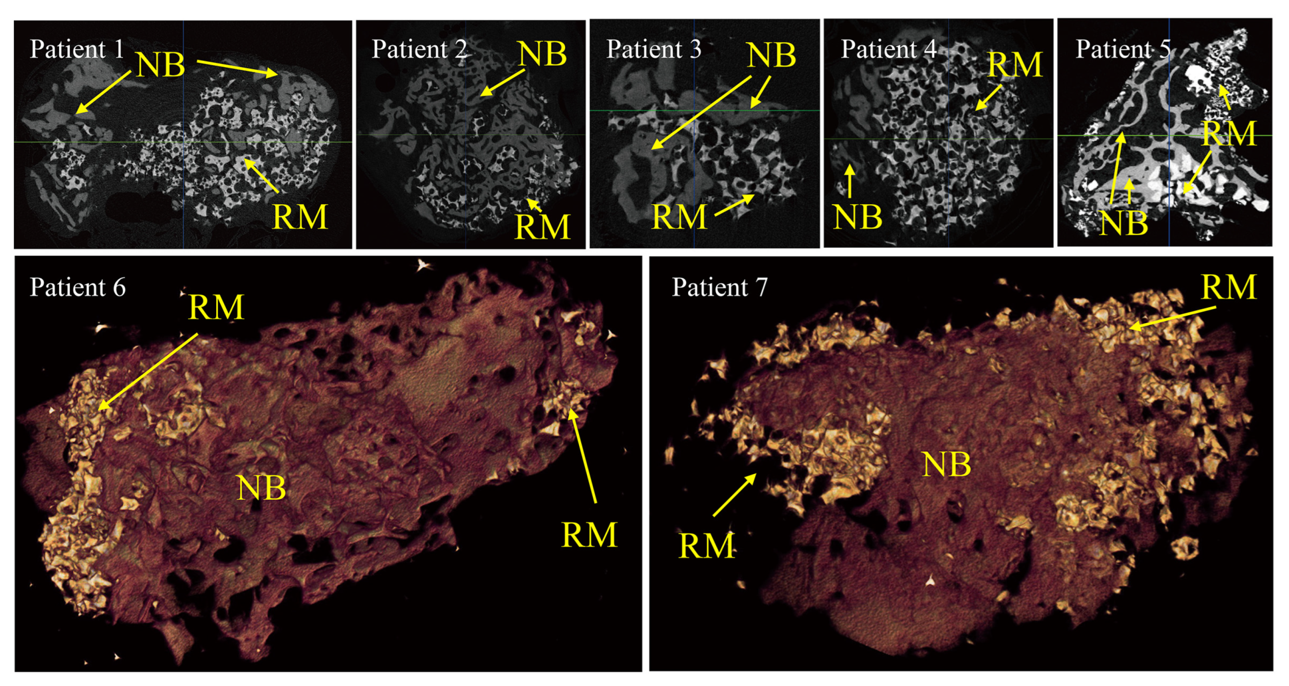 Medicina 59 00176 g002 Medicina 59 00176 g002