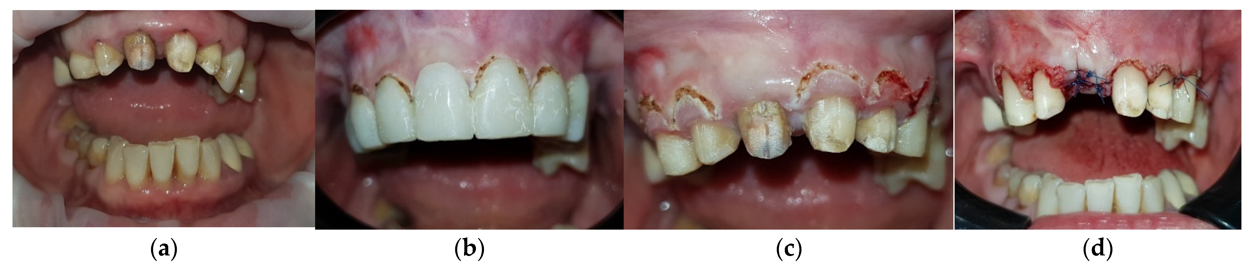 Medicina 59 00197 g005 Medicina 59 00197 g005