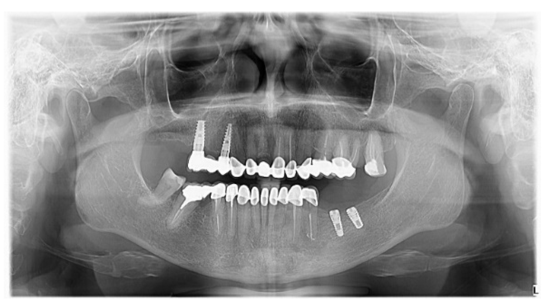 Medicina 59 00197 g010 Medicina 59 00197 g010