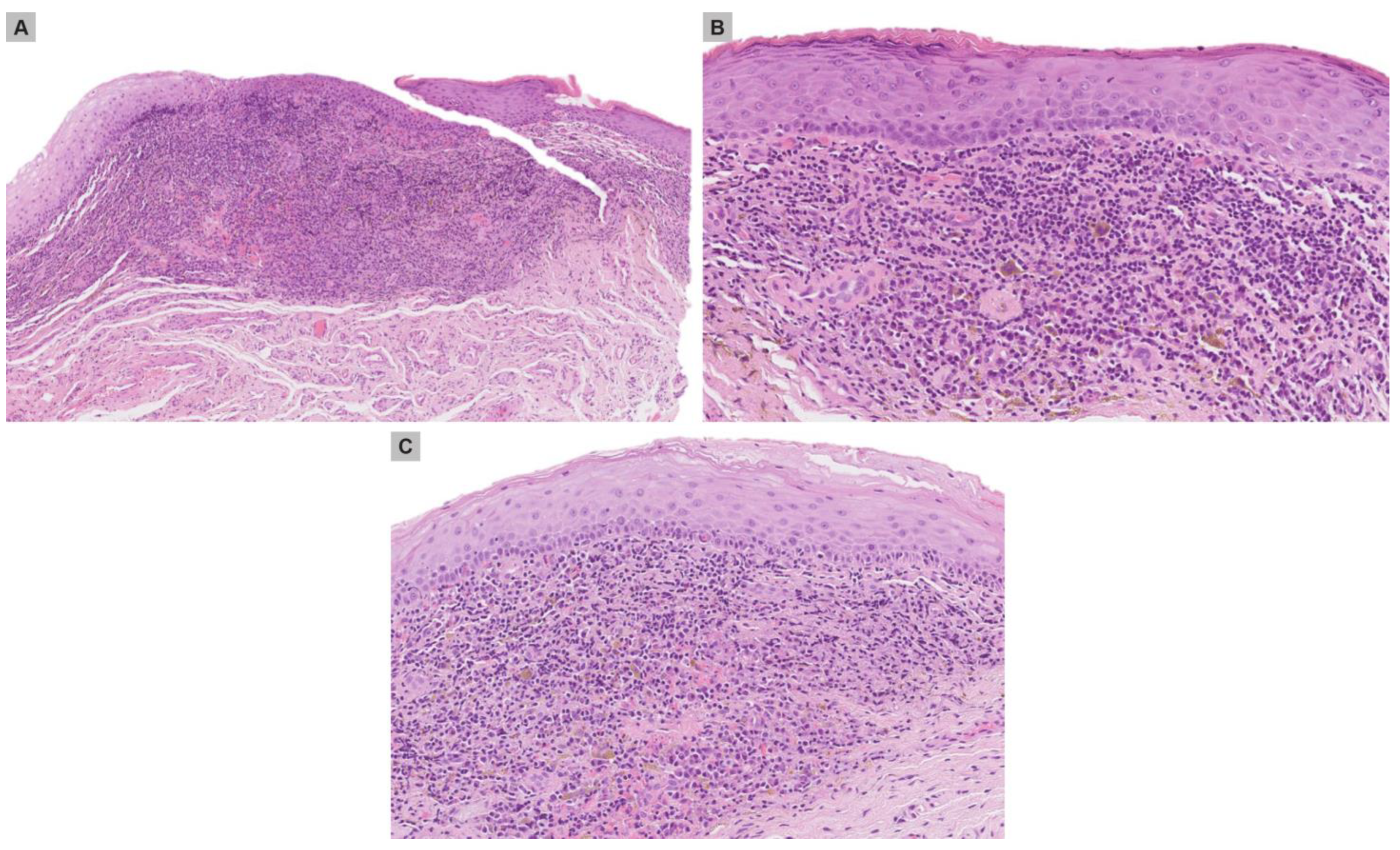 Medicina 59 00206 g003 Medicina 59 00206 g003