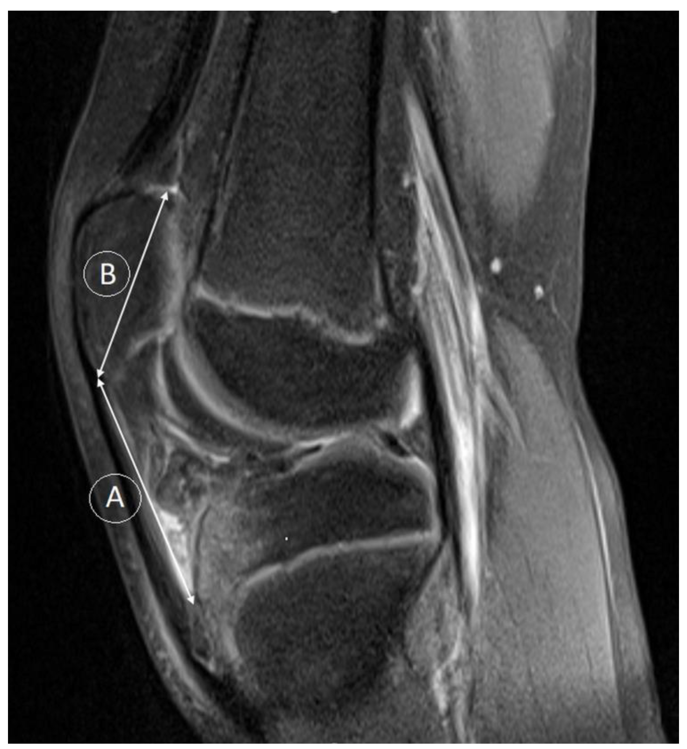 Medicina 59 00213 g003 Medicina 59 00213 g003