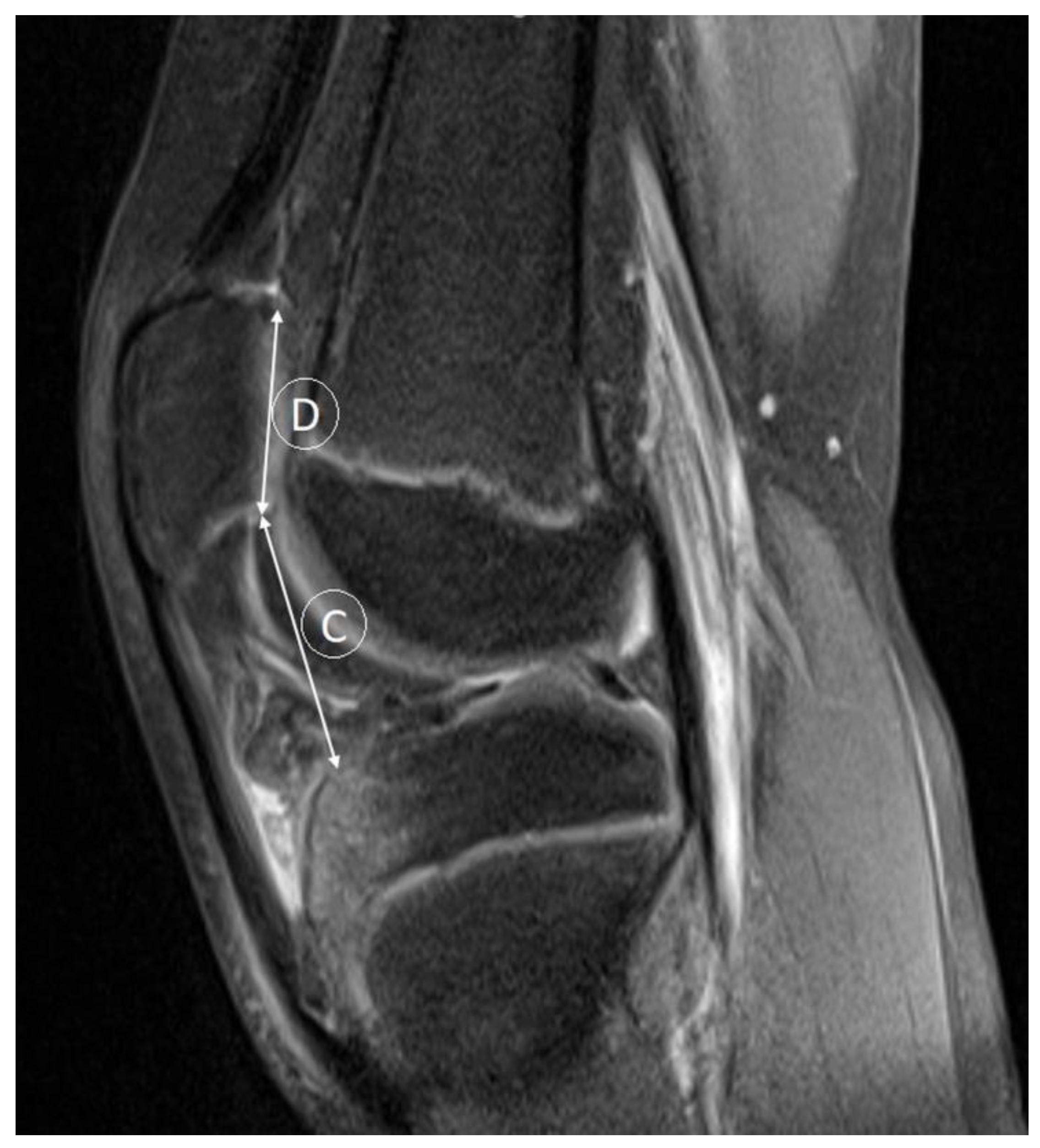 Medicina 59 00213 g004 Medicina 59 00213 g004